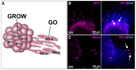 Targeting Key Signaling Pathways in Glioblastoma Stem Cells for