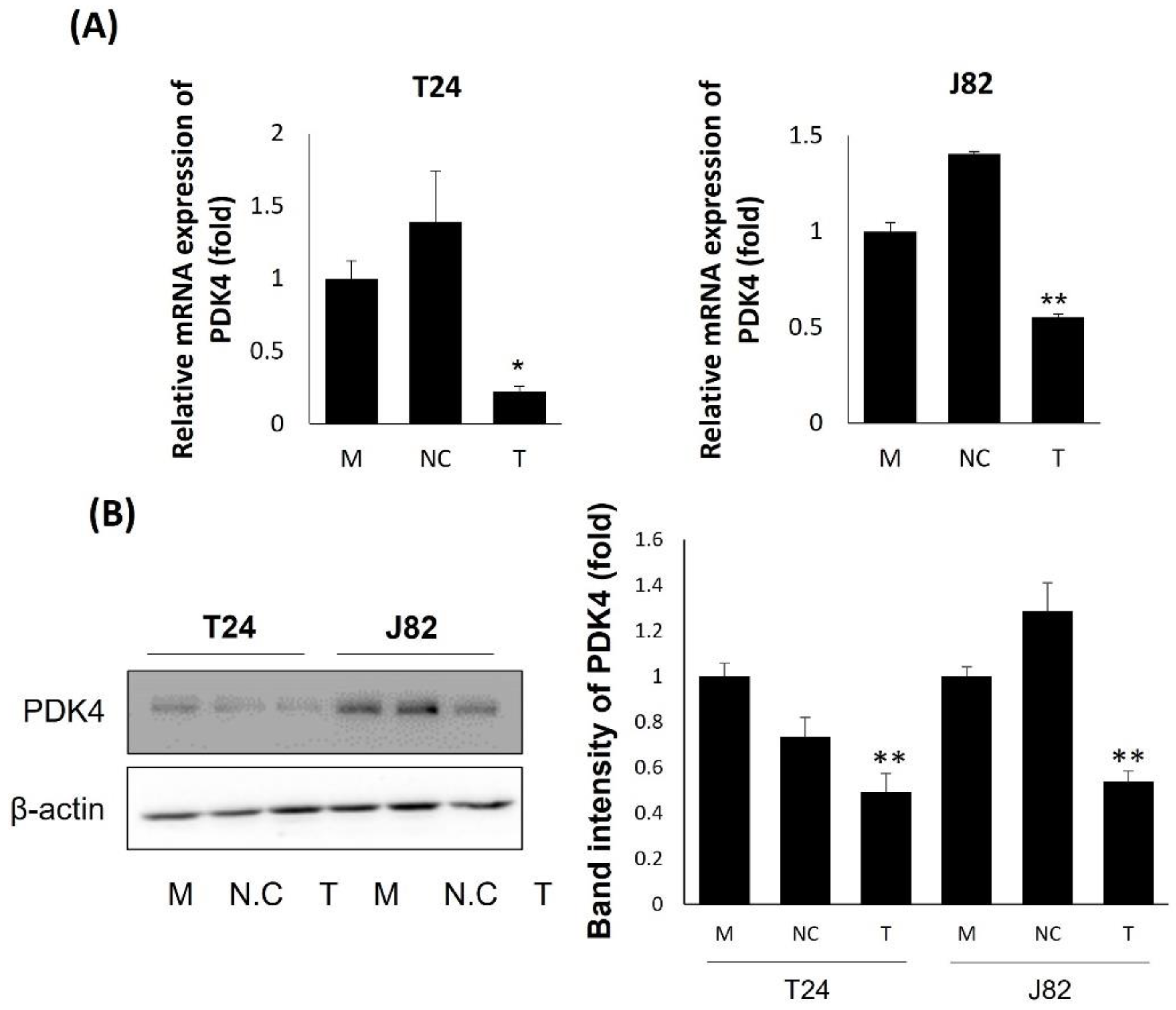 IJMS Free Full-Text Anti-Metastatic Effect of Pyruvate Dehydrogenase Kinase 4 Inhibition in Bladder Cancer via the ERK, SRC, and JNK Pathways photo