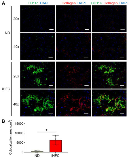 Roles of Macrophages in Advanced Liver Fibrosis, Identified