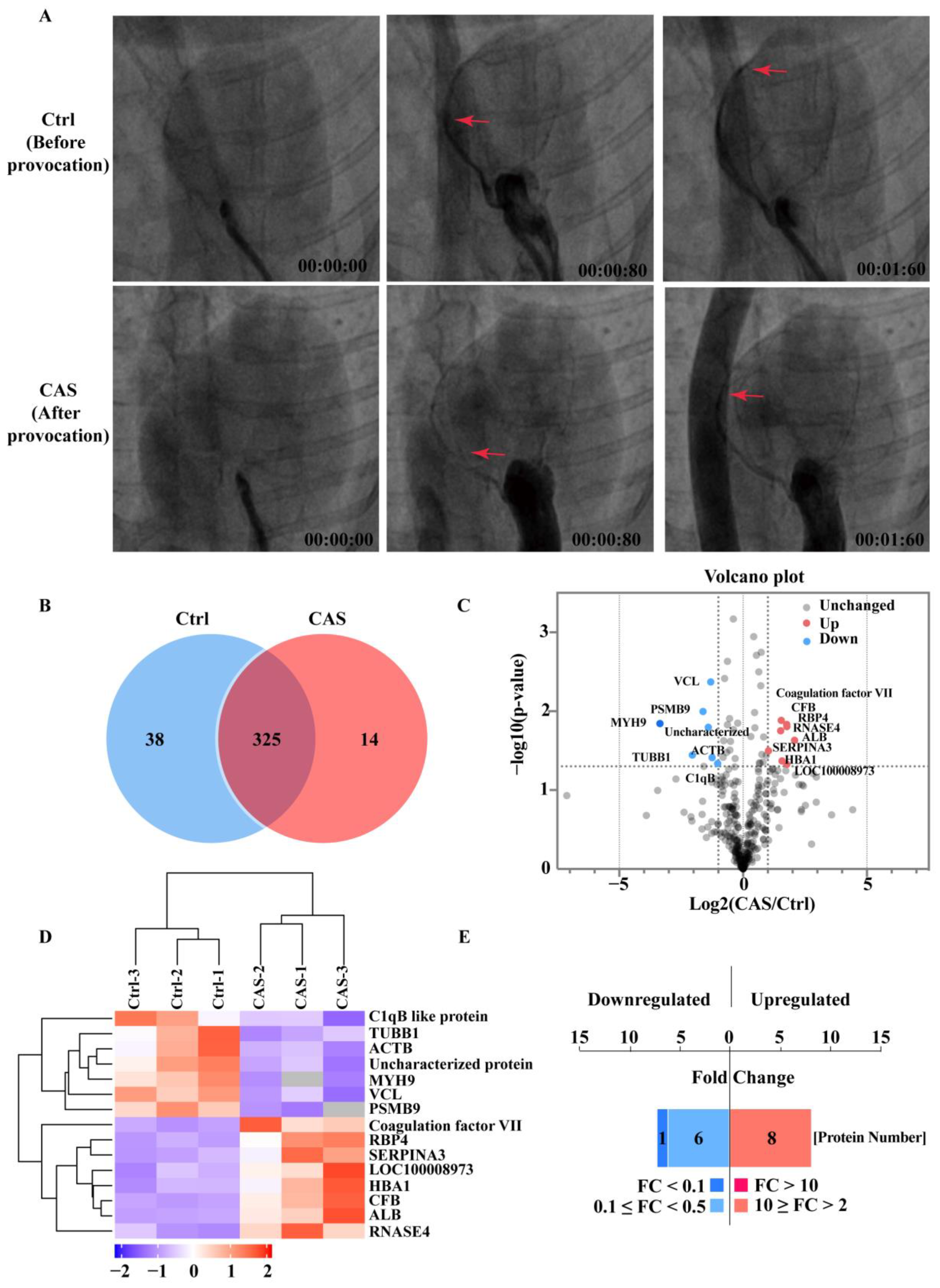 IJMS Free Full-Text Serum SELENBP1 and VCL Are Effective Biomarkers for Clinical and Forensic Diagnosis of Coronary Artery Spasm hq nude picture