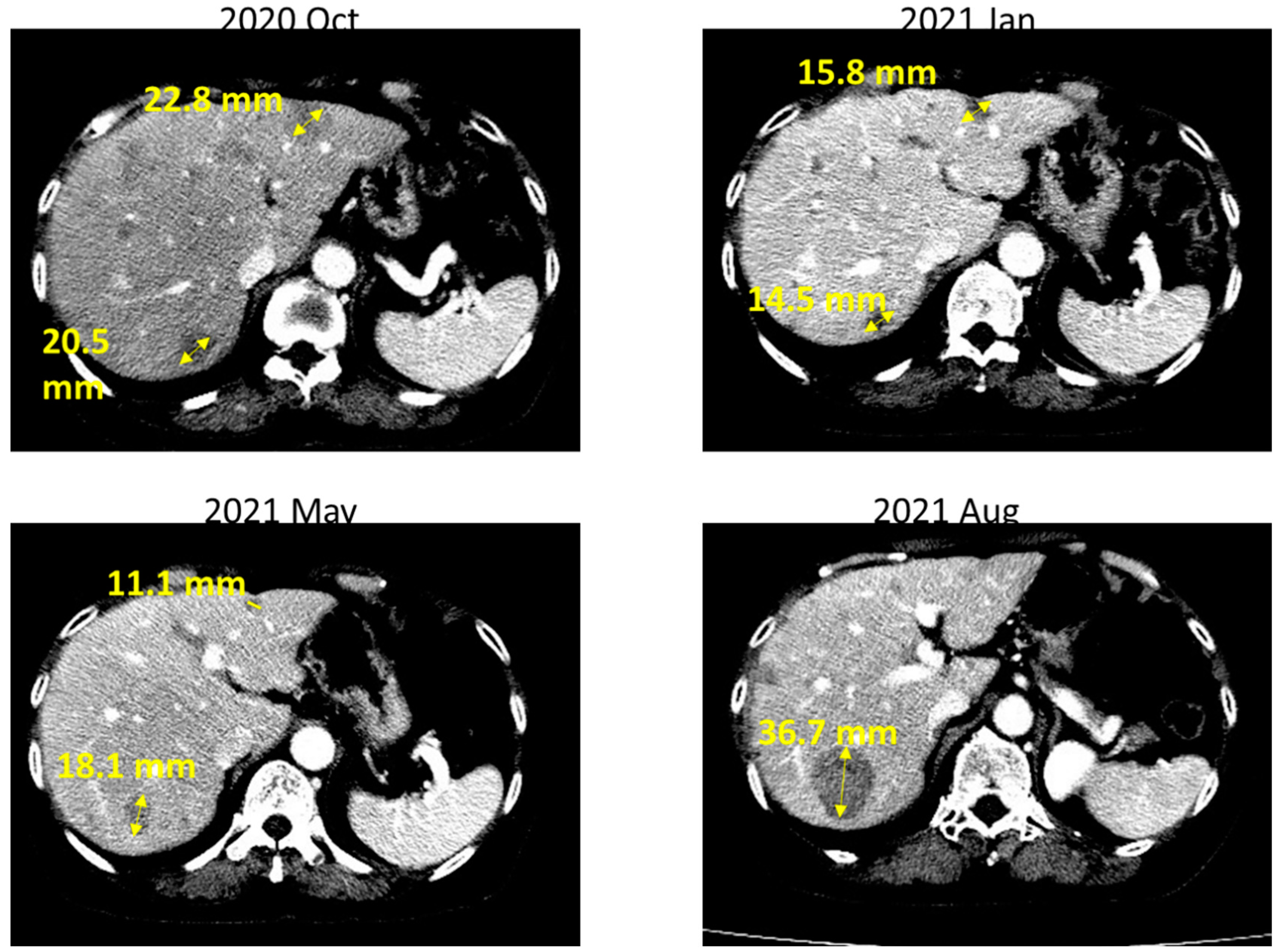 Ijms 23 13451 g003 Ijms 23 13451 g003