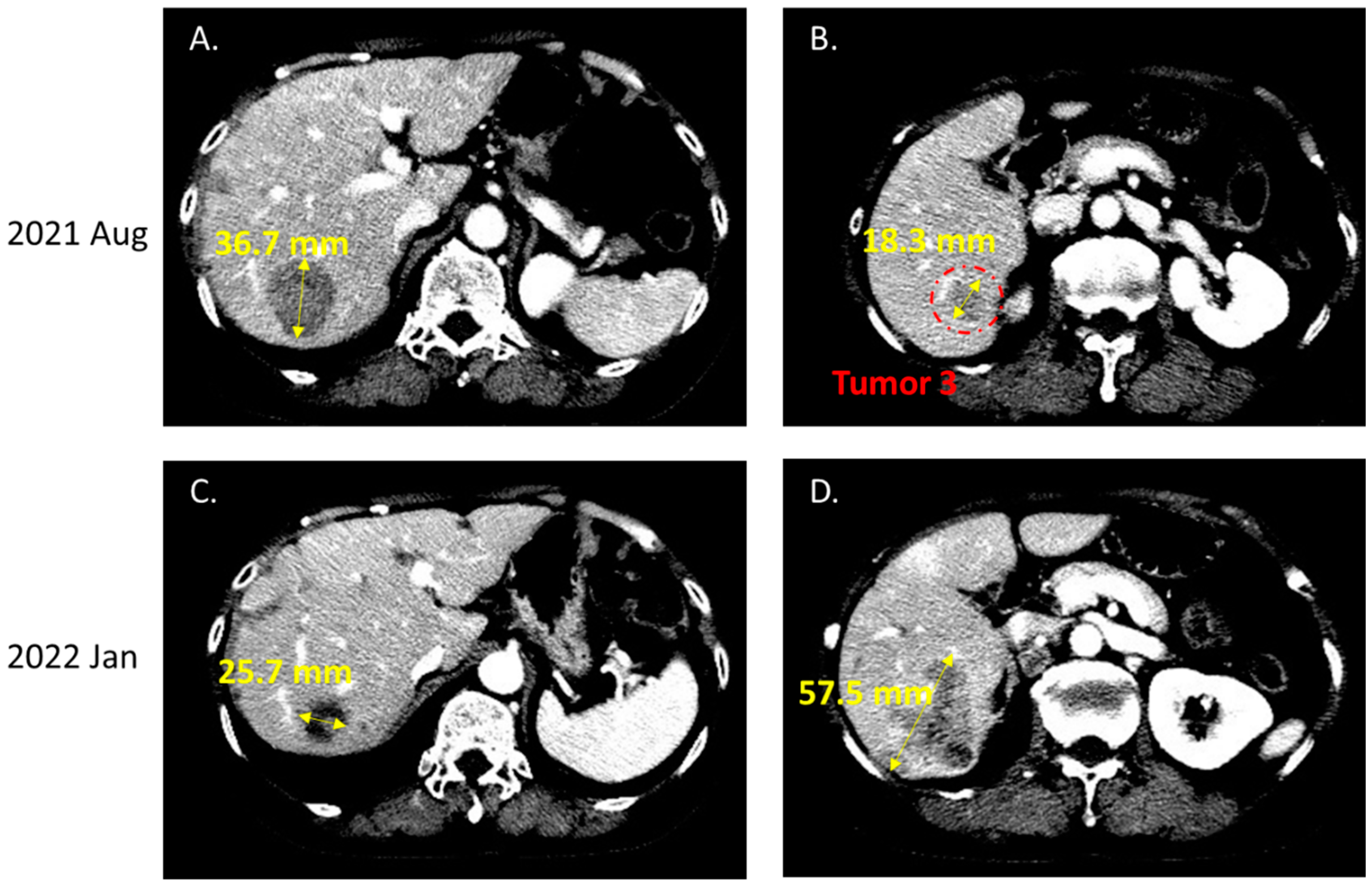 Ijms 23 13451 g005 Ijms 23 13451 g005
