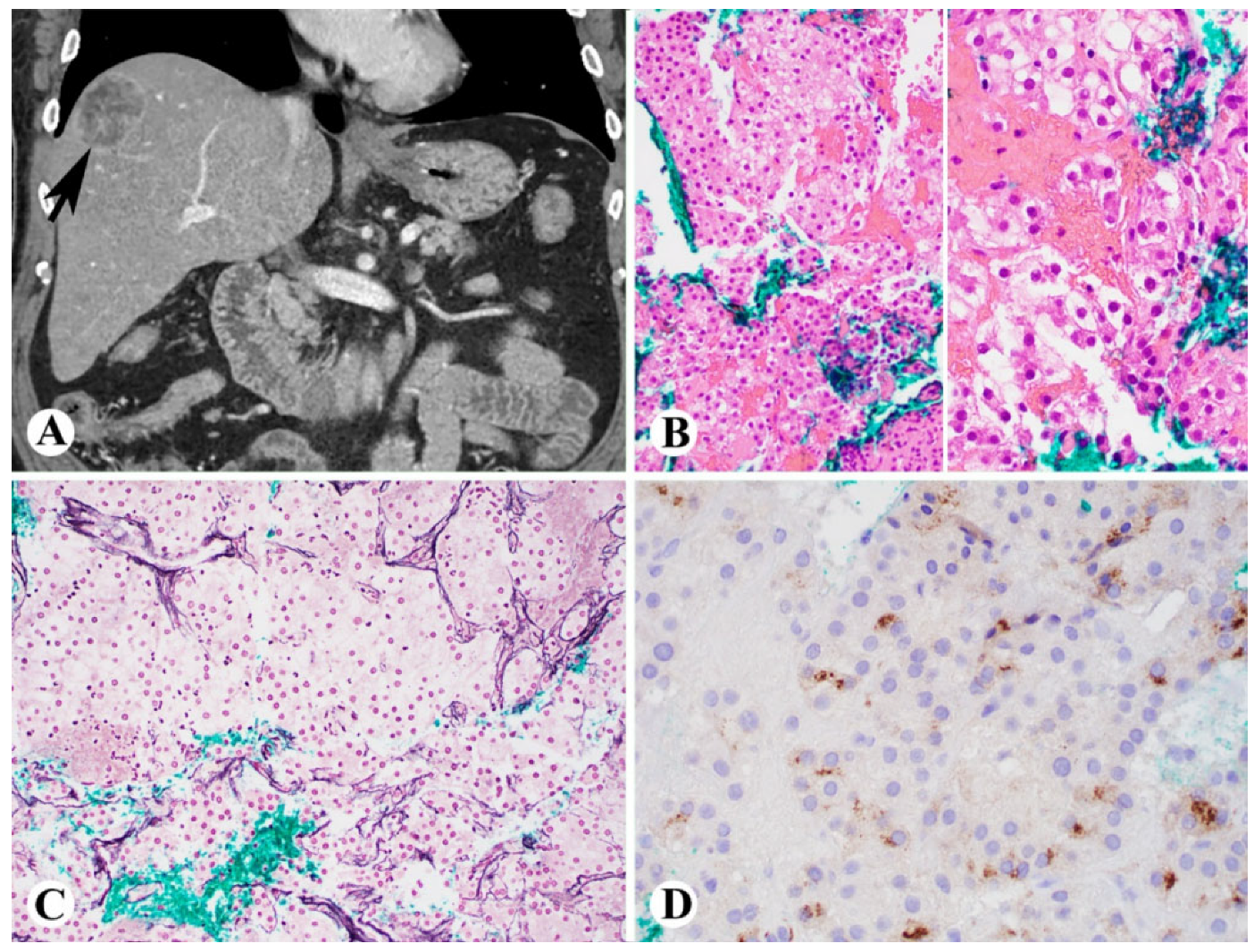 Ijms 23 13501 g003 Ijms 23 13501 g003