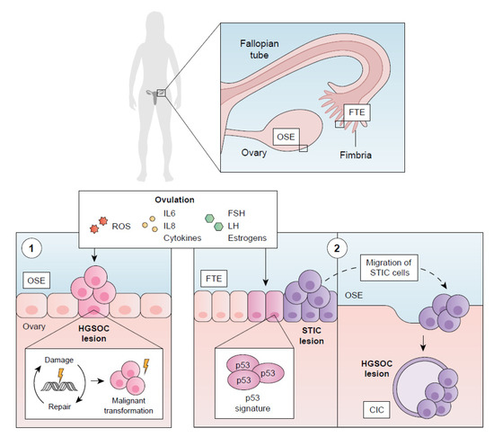 Molecular Management of High-Grade Serous Ovarian Carcinoma