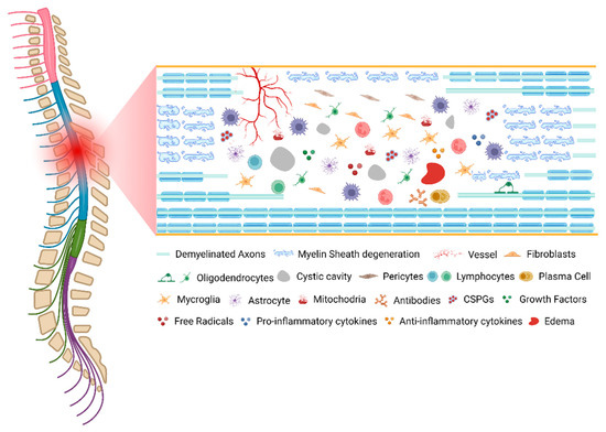 Pathophysiology and Therapeutic Approaches for Spinal Cord
