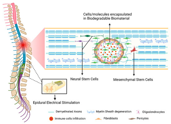 Pathophysiology and Therapeutic Approaches for Spinal Cord
