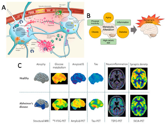 Collage of various research approaches for Alzheimer's