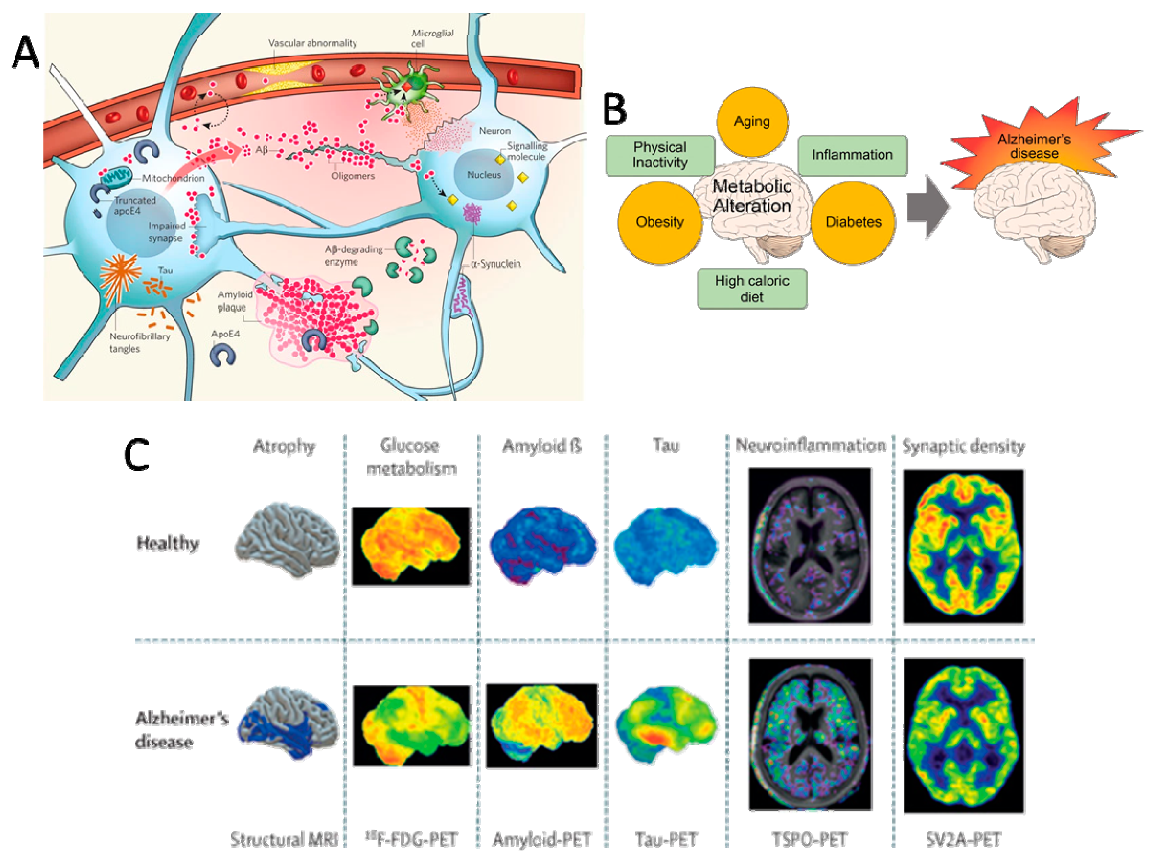 neurontin alzheimers disease