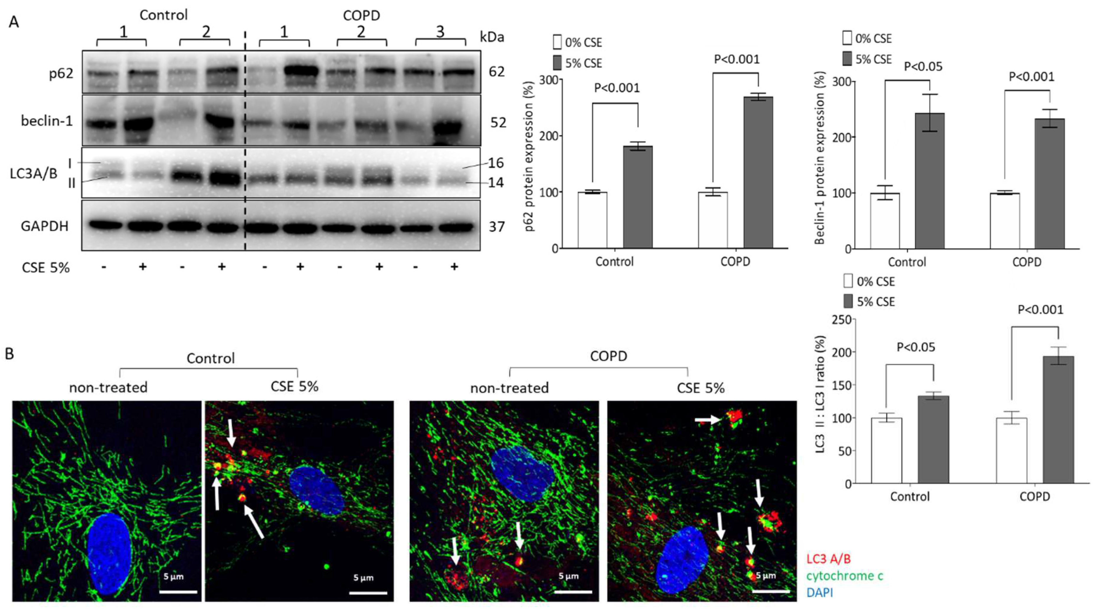 Ijms 23 13987 g004 Ijms 23 13987 g004