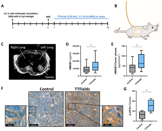 Tumor Treating Fields (TTFields) Concomitant with Immune