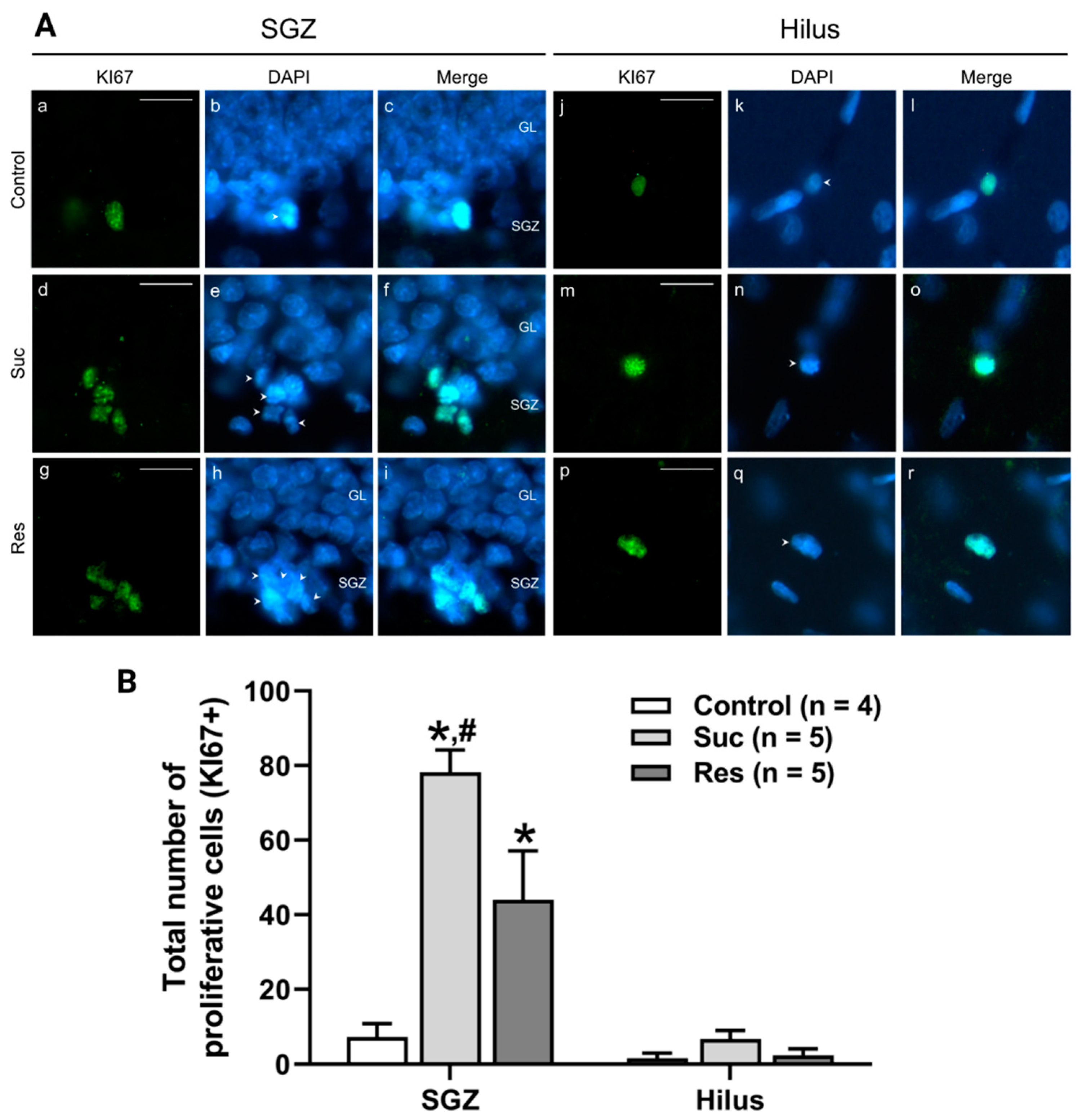 Ijms 23 14176 g004 Ijms 23 14176 g004