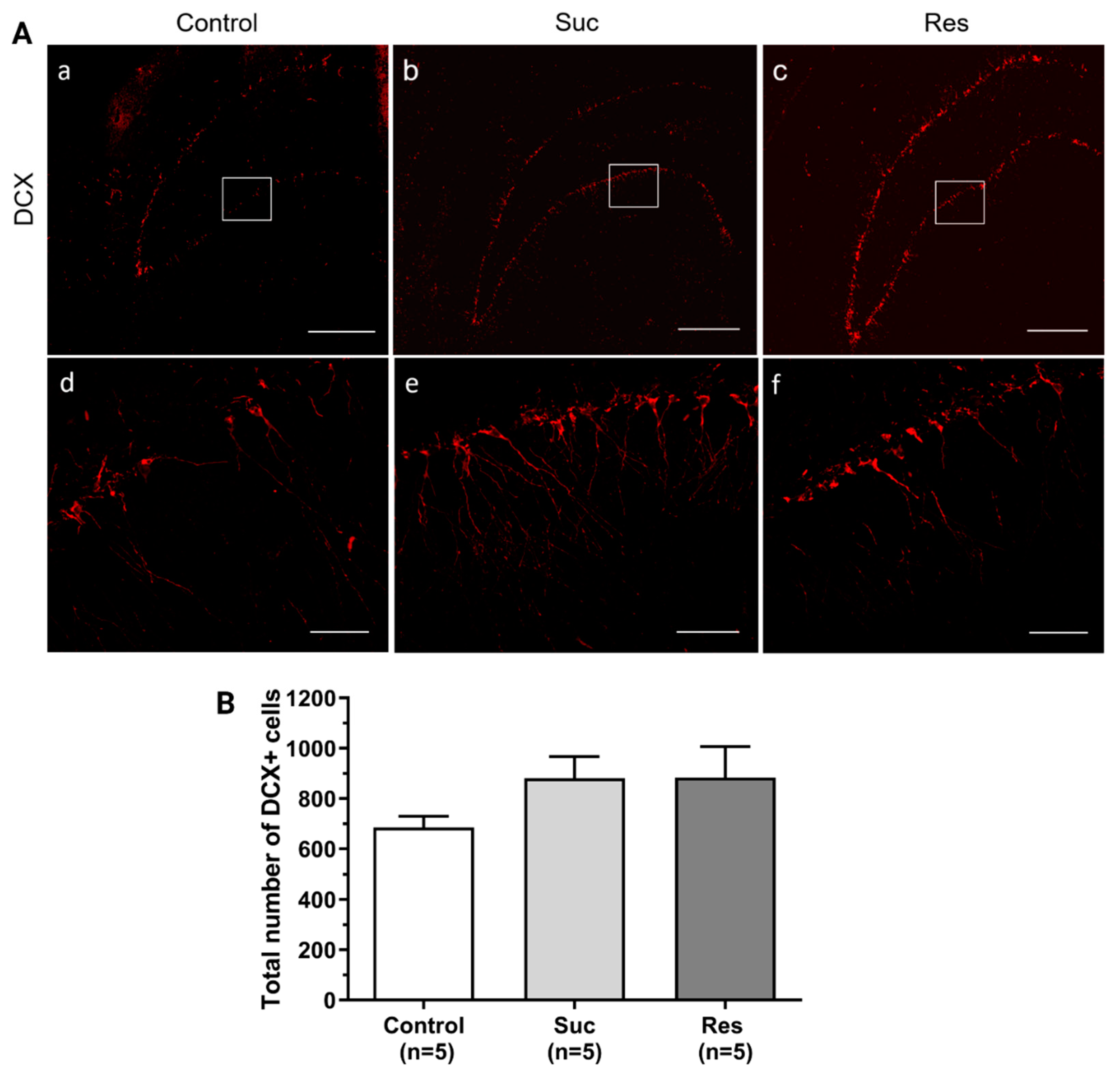 Ijms 23 14176 g006 Ijms 23 14176 g006