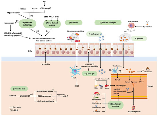 The Role of the Gallbladder, the Intestinal Barrier and the Gut
