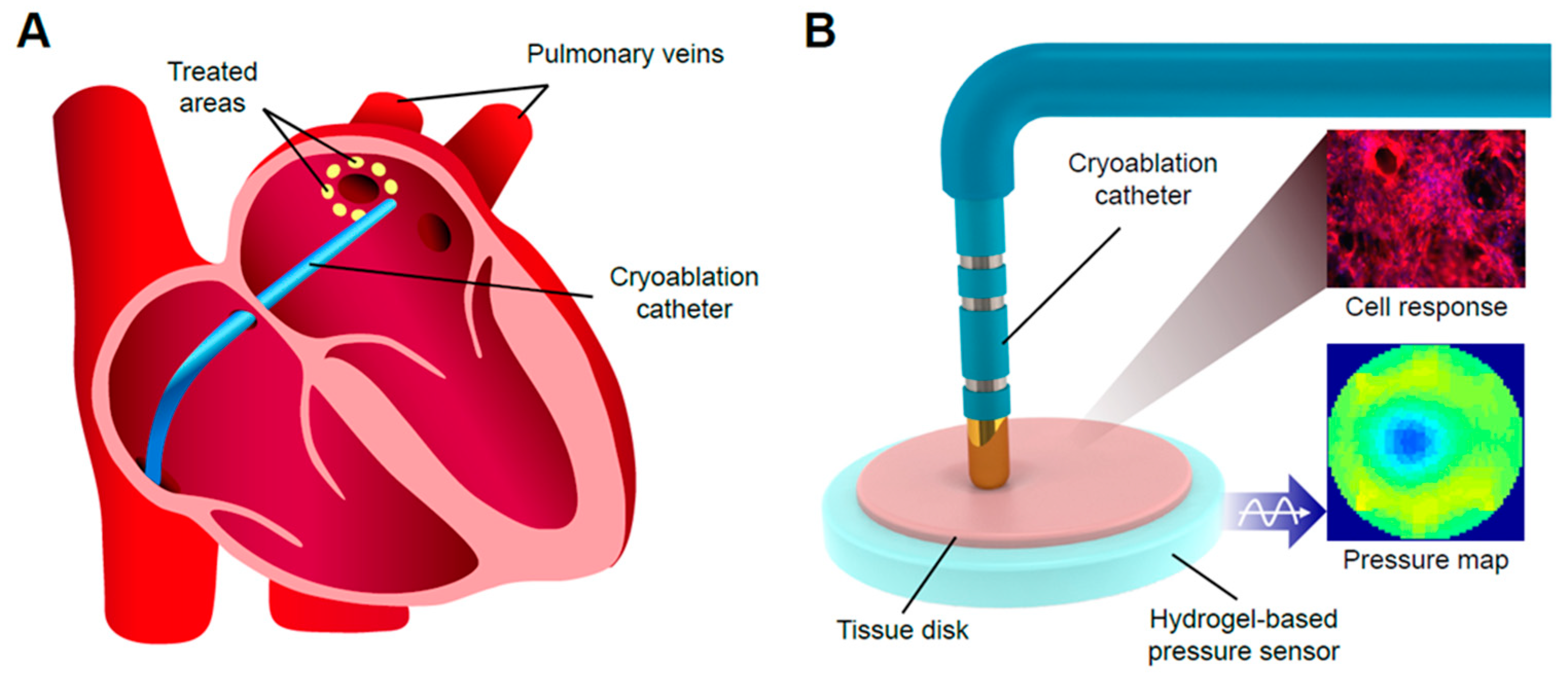 IJMS | Free Full-Text | A Bionic Testbed for Cardiac Ablation Tools