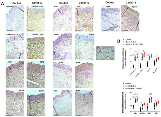 N-acetylcysteine Reduces Inflammasome Activation Induced by