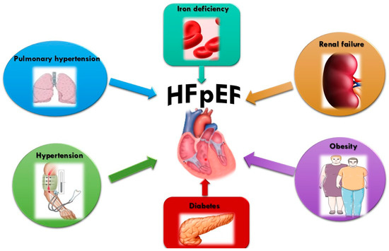 IJMS Free Full Text Treatment Of HFpEF Beyond The SGLT2 Is Does ijms-free-full-text-treatment-of-hfpef-beyond-the-sglt2-is-does