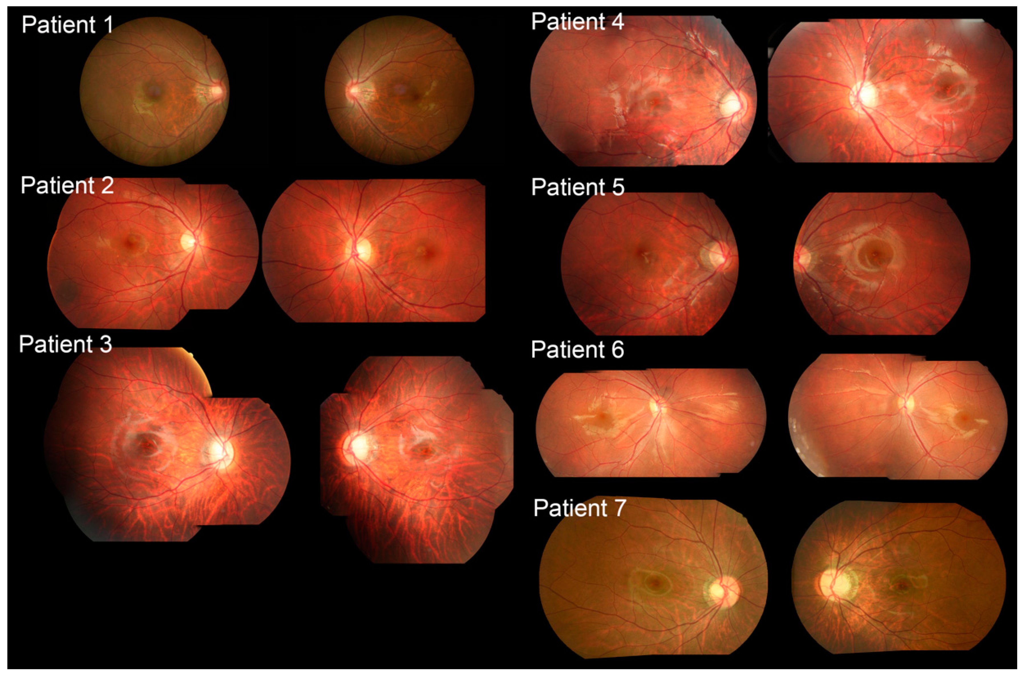 Ijms 23 14965 g001 Ijms 23 14965 g001