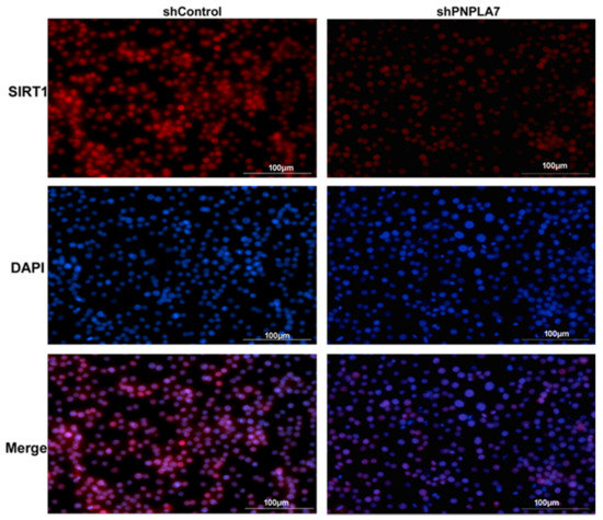 The Patatin–Like Phospholipase Domain Containing Protein 7