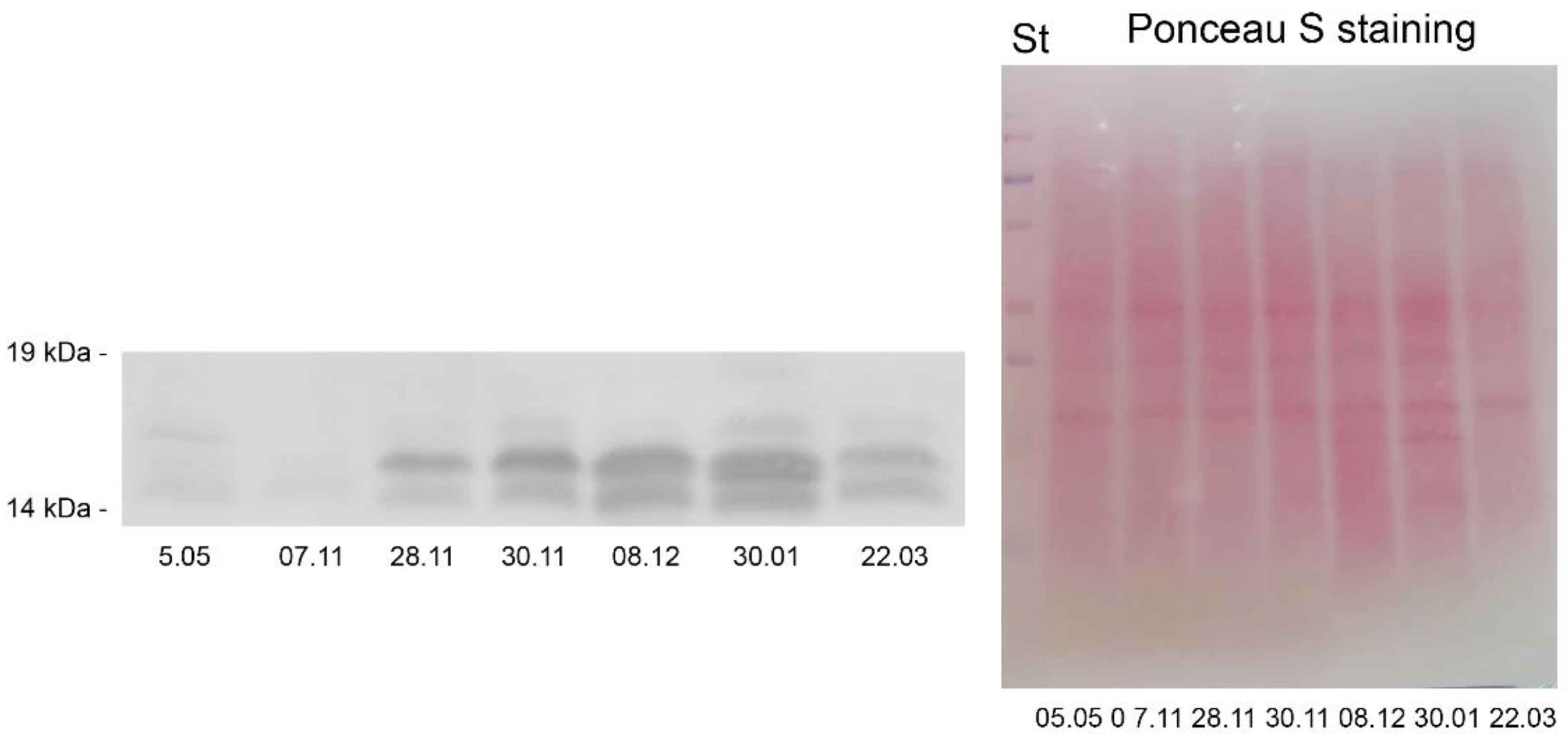 Ijms 23 15050 g009 Ijms 23 15050 g009