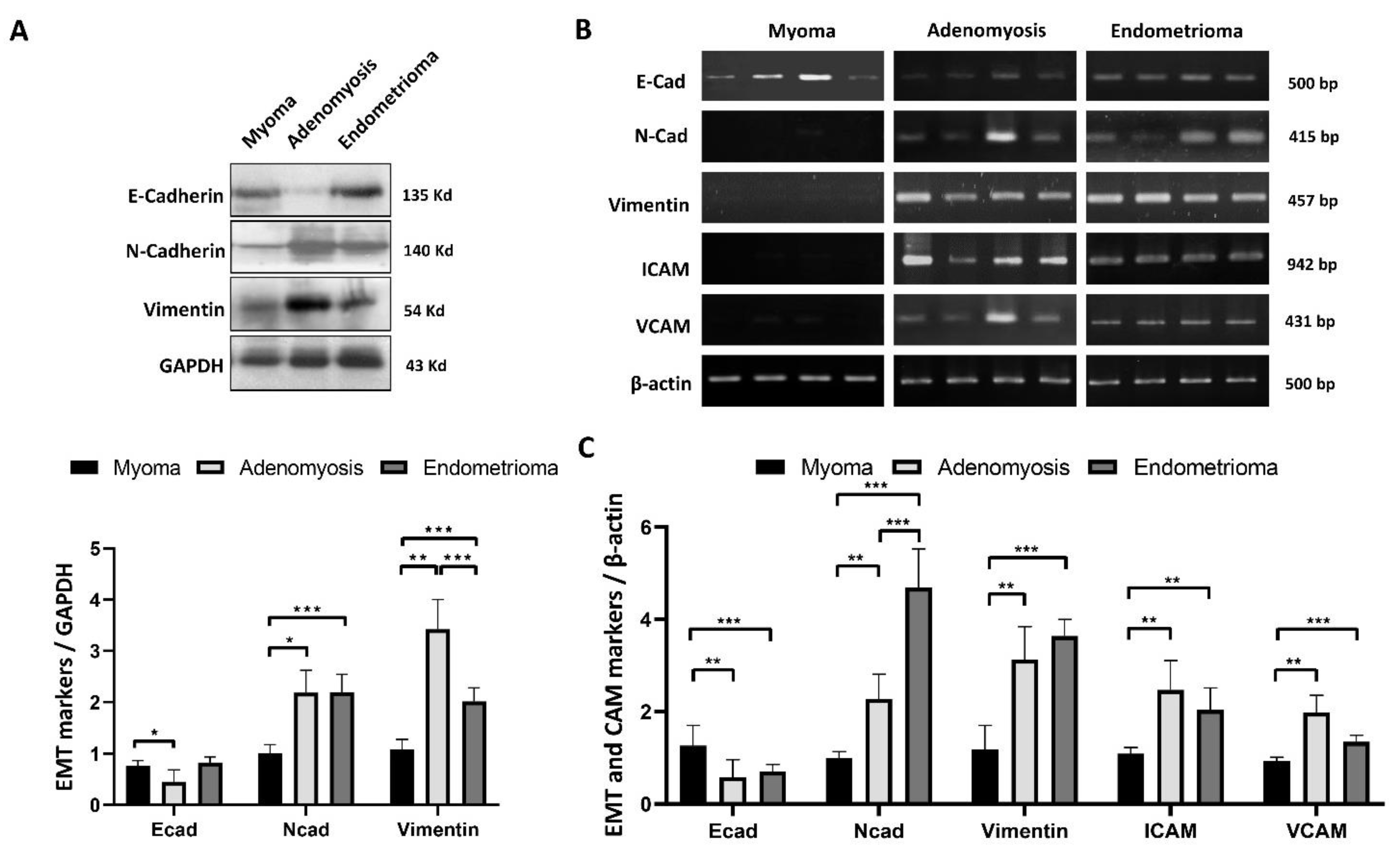 IJMS Free FullText Osteopontin Splicing Isoforms Contribute to
