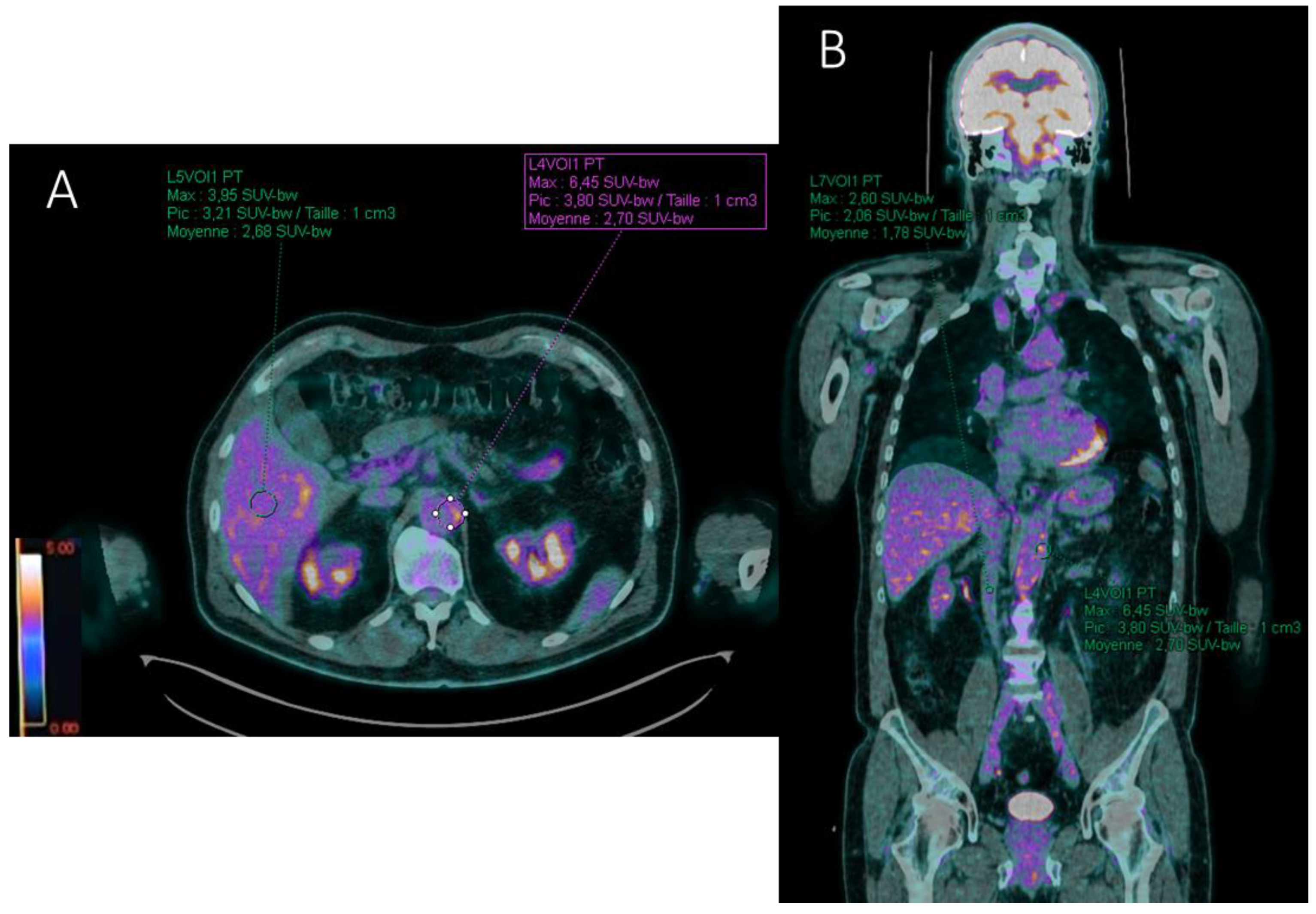 Ijms 23 15528 g004 Ijms 23 15528 g004