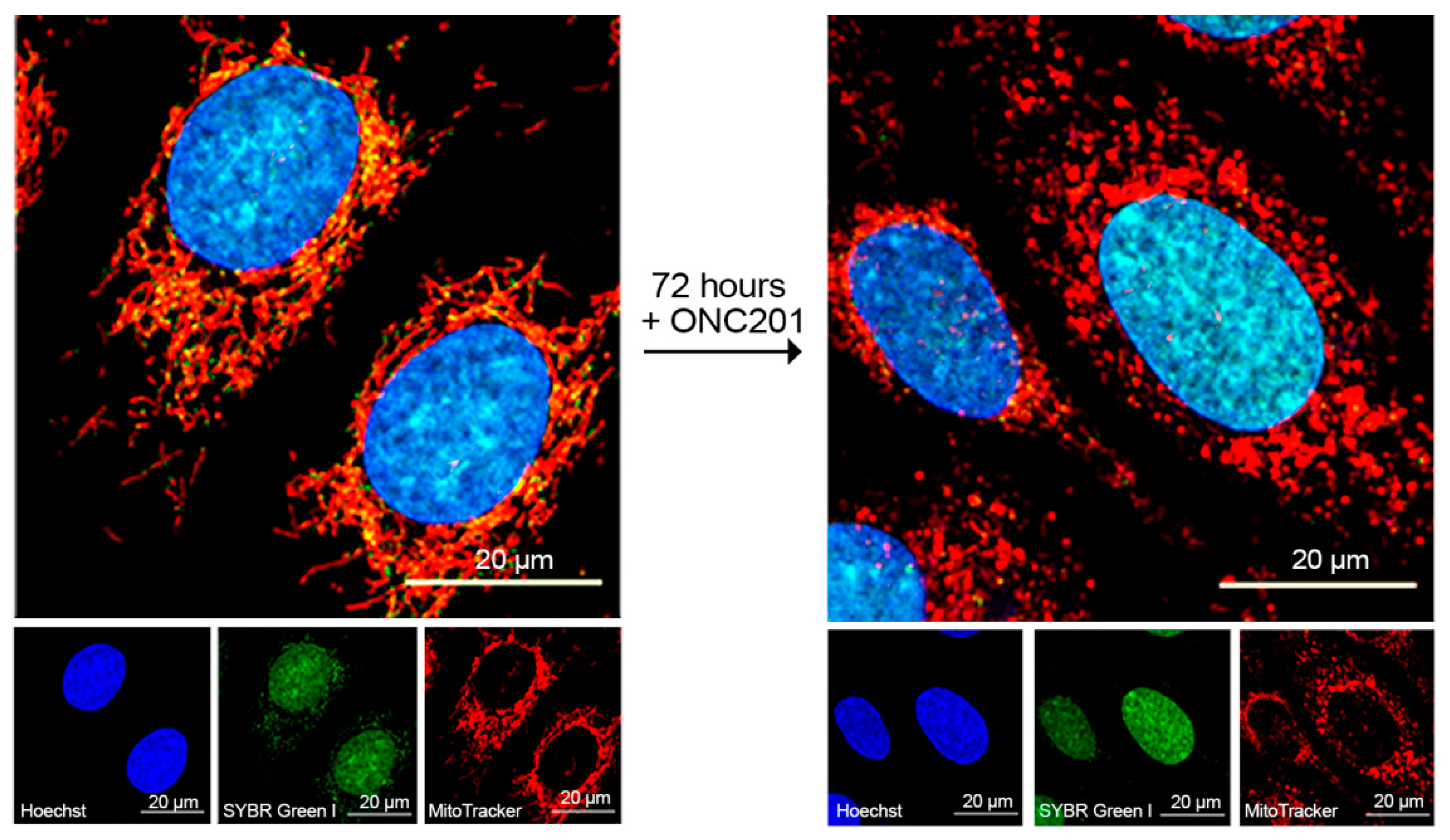 IJMS | Free Full-Text | ONC201-Induced Mitochondrial Dysfunction ...