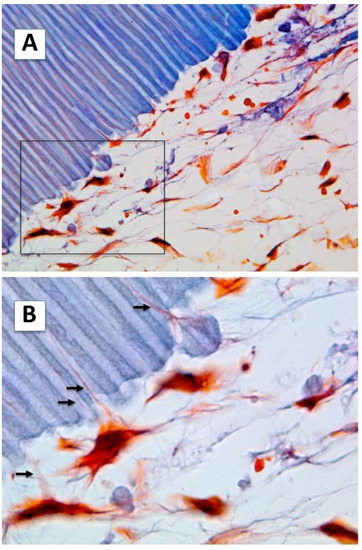 Human Dental Pulp Stem Cells Differentiate into Cementoid-Like ...
