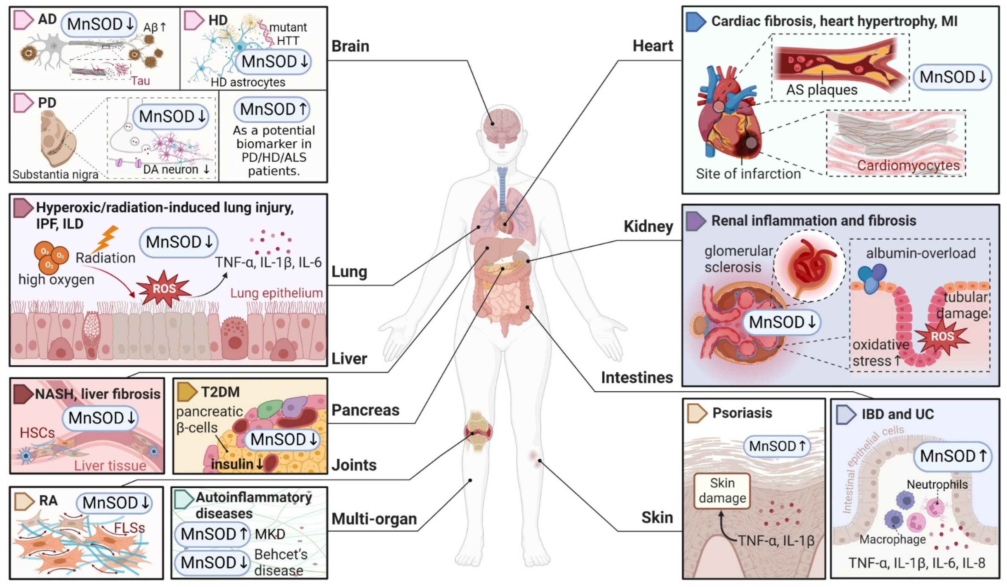 Extra high superoxide dismutase in host tissue is associated with