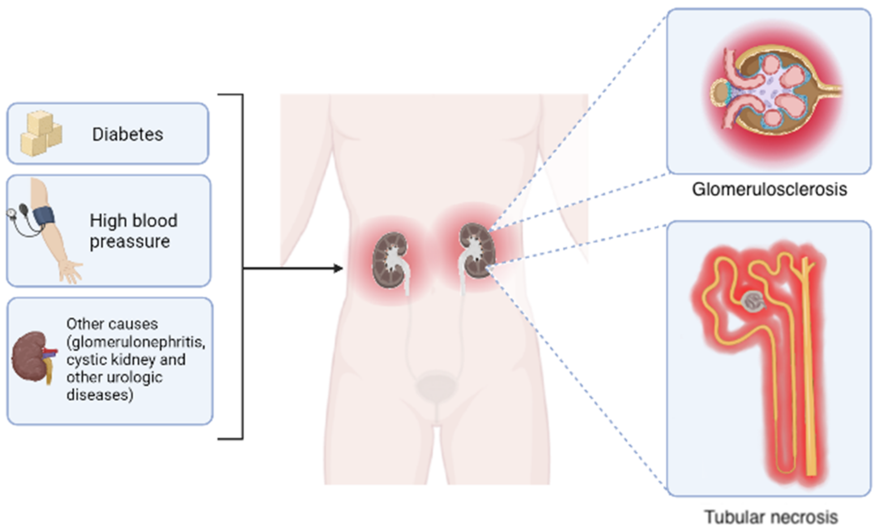Hypertensive kidney clearance disease