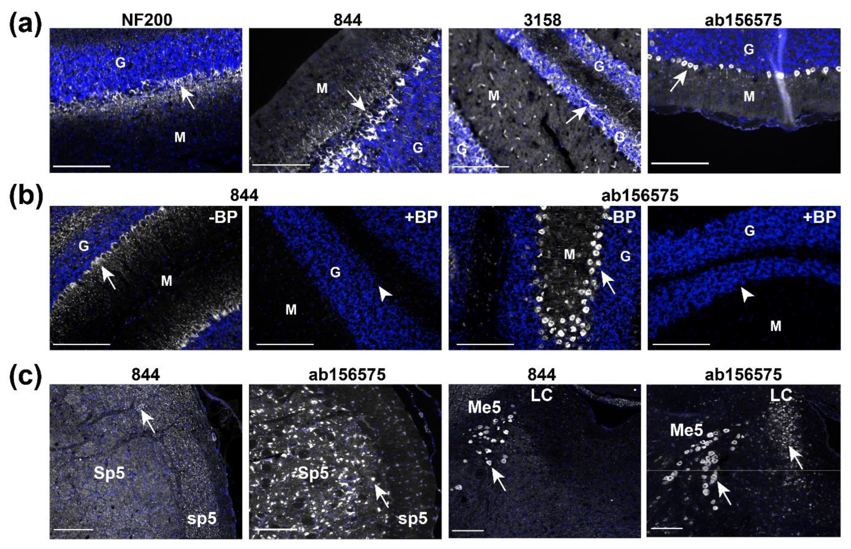 Ijms 23 16035 g004 Ijms 23 16035 g004