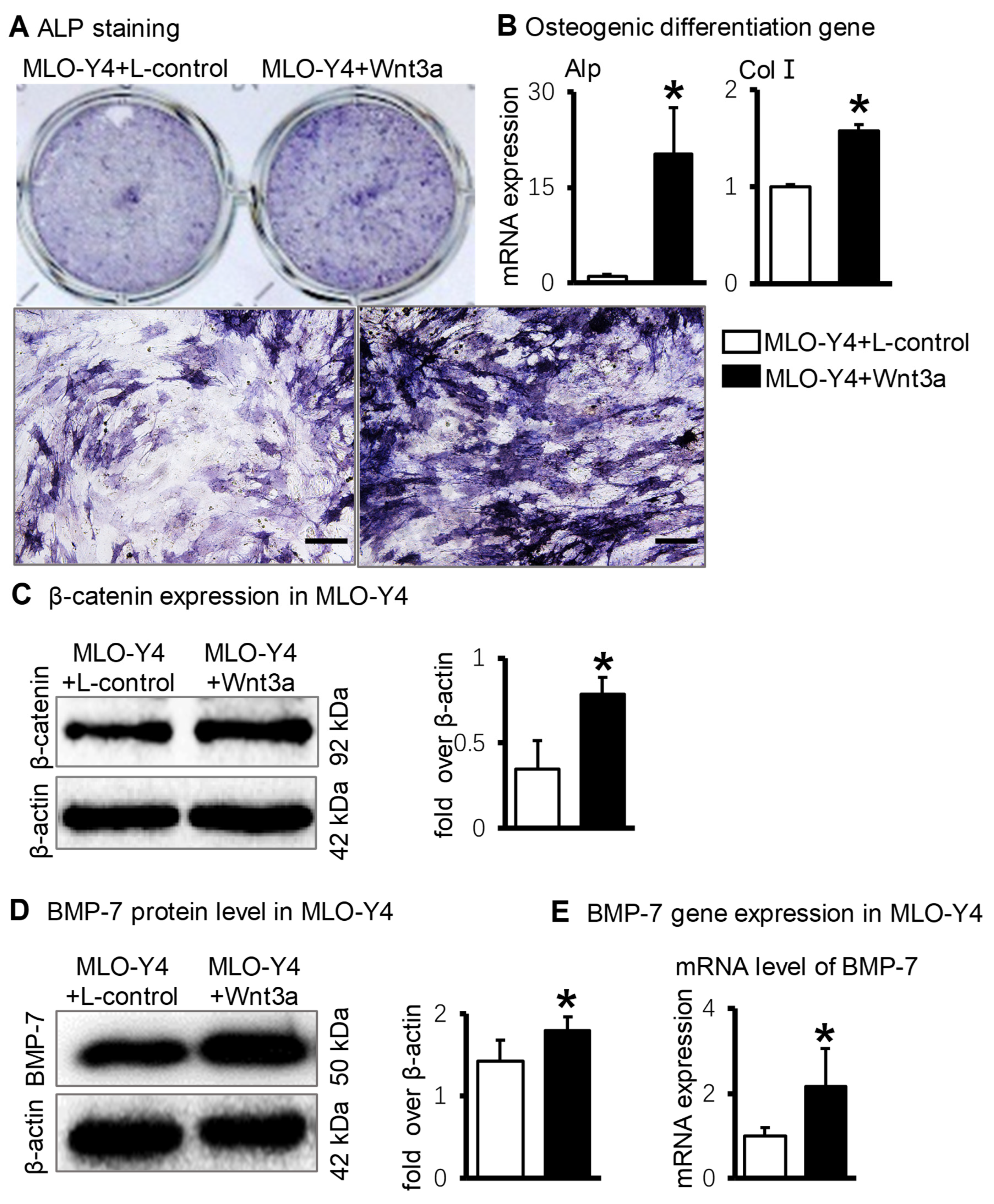 スーパーセール タイムセール 時間 Activating Promotes Osteocytes in Signaling Wnt/β-Catenin ジャケット・アウター