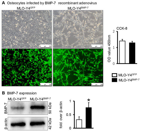 その他 T.K Frontiers | Activin receptor-like kinase 3: a critical