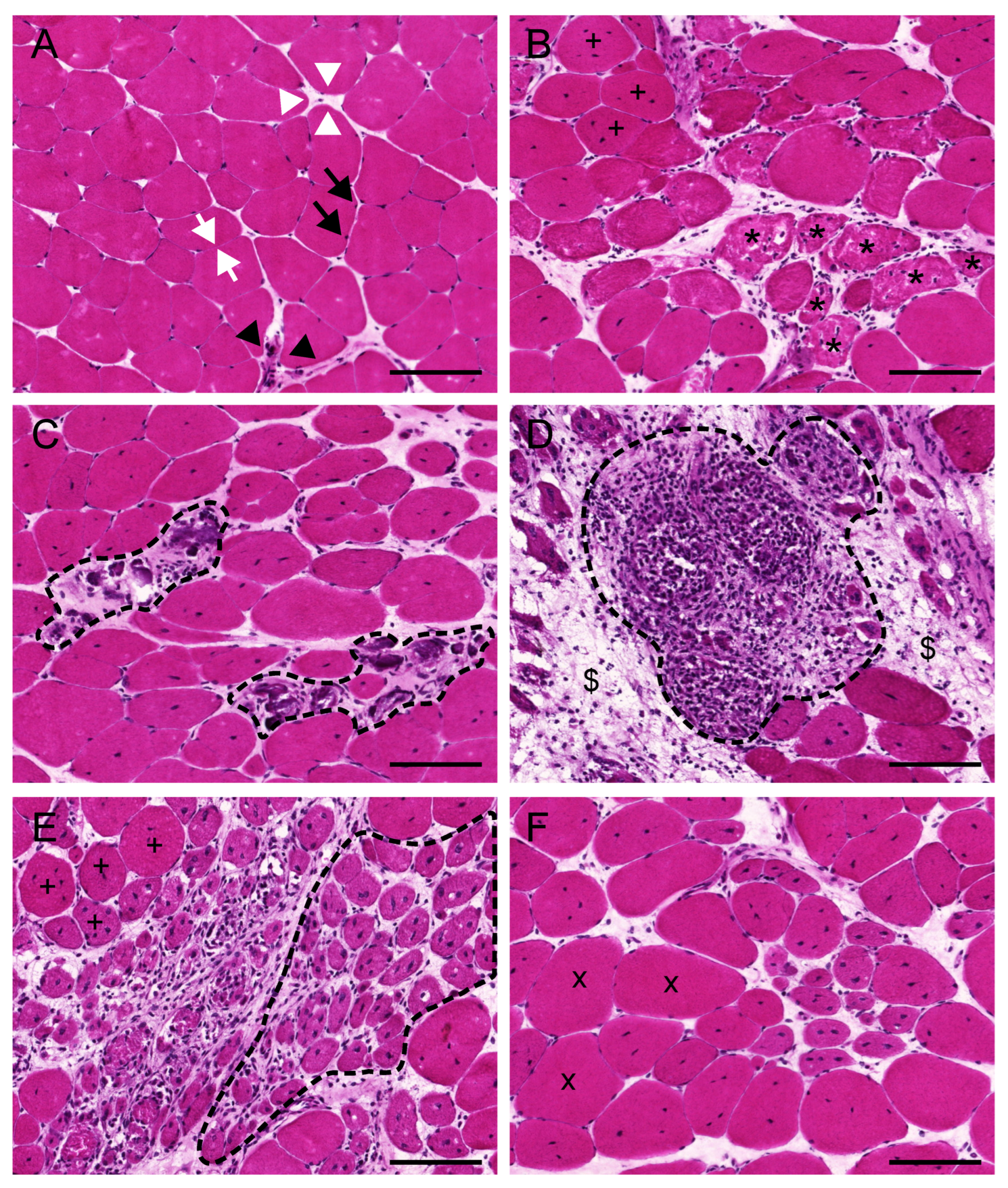 IJMS | Free Full-Text | Histological Methods to Assess Skeletal Muscle  Degeneration and Regeneration in Duchenne Muscular Dystrophy