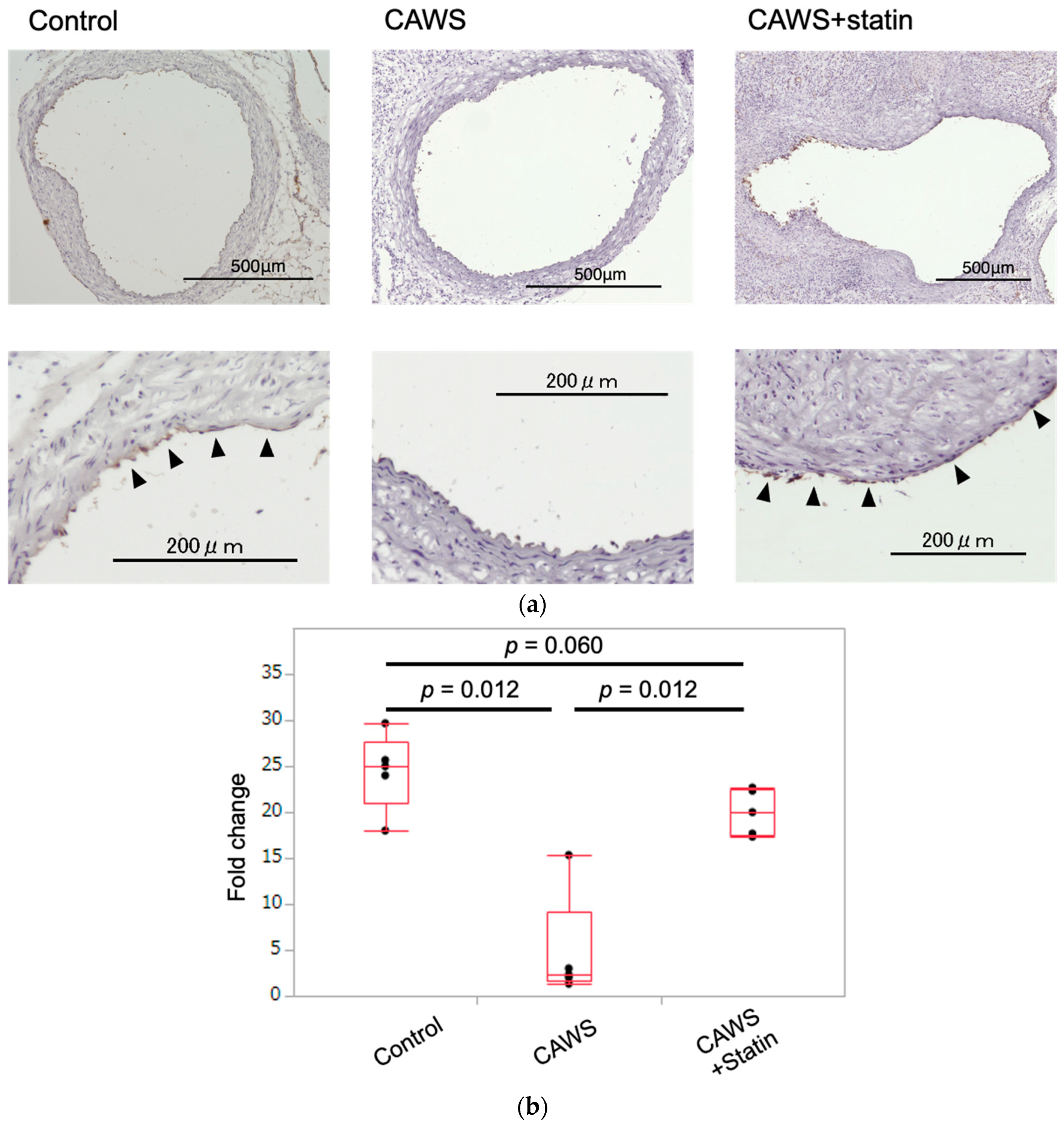 IJMS Free Full-Text Statins Show Anti-Atherosclerotic Effects by Improving Endothelial Cell Function in a Kawasaki Disease-like Vasculitis Mouse Model pic