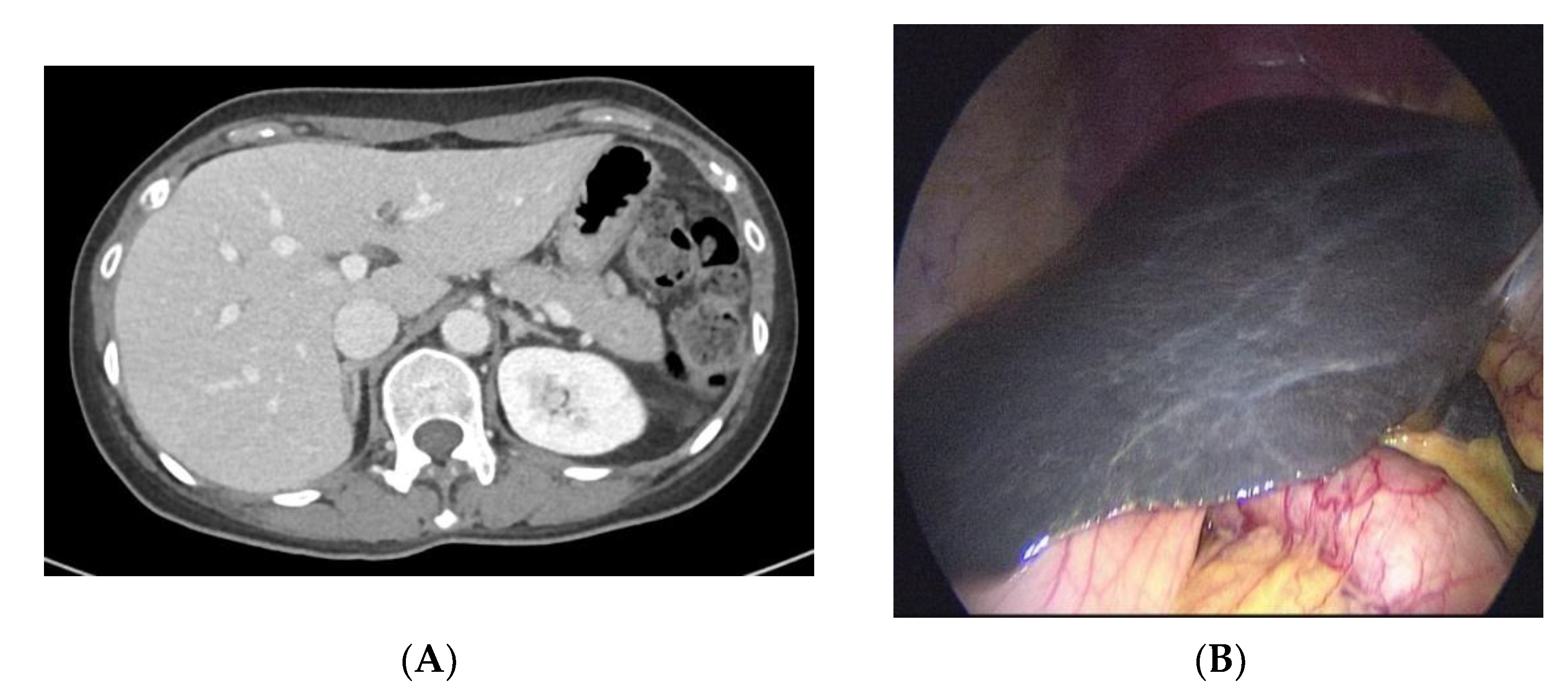 Ijms 23 16168 g001 Ijms 23 16168 g001