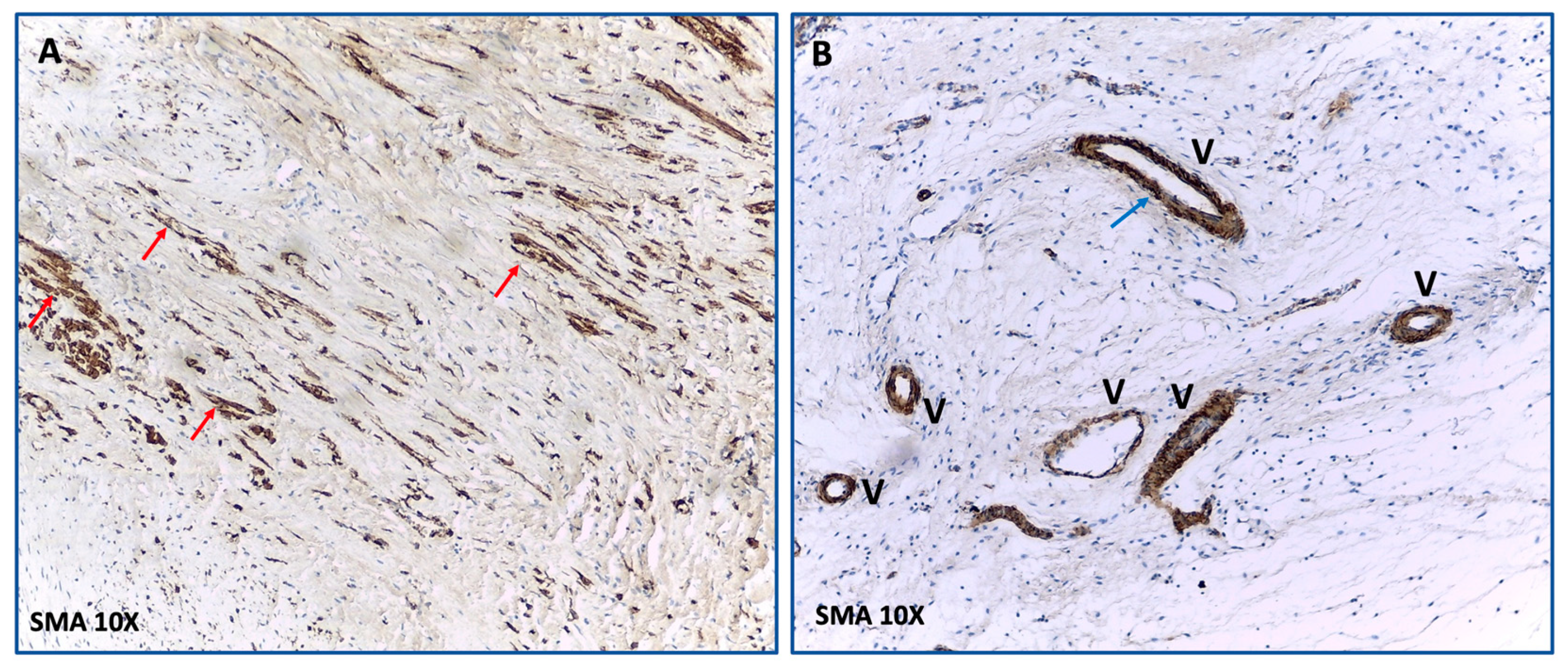 Ijms 23 16211 g005 Ijms 23 16211 g005