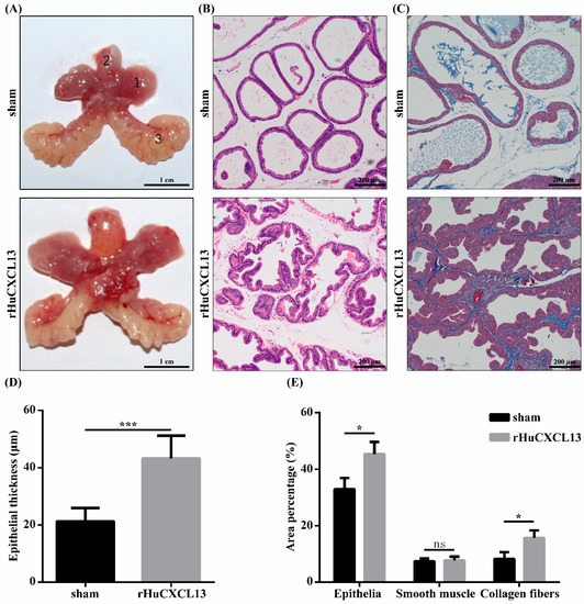 Changes in the Expression and Functional Activities of C-X-C Motif
