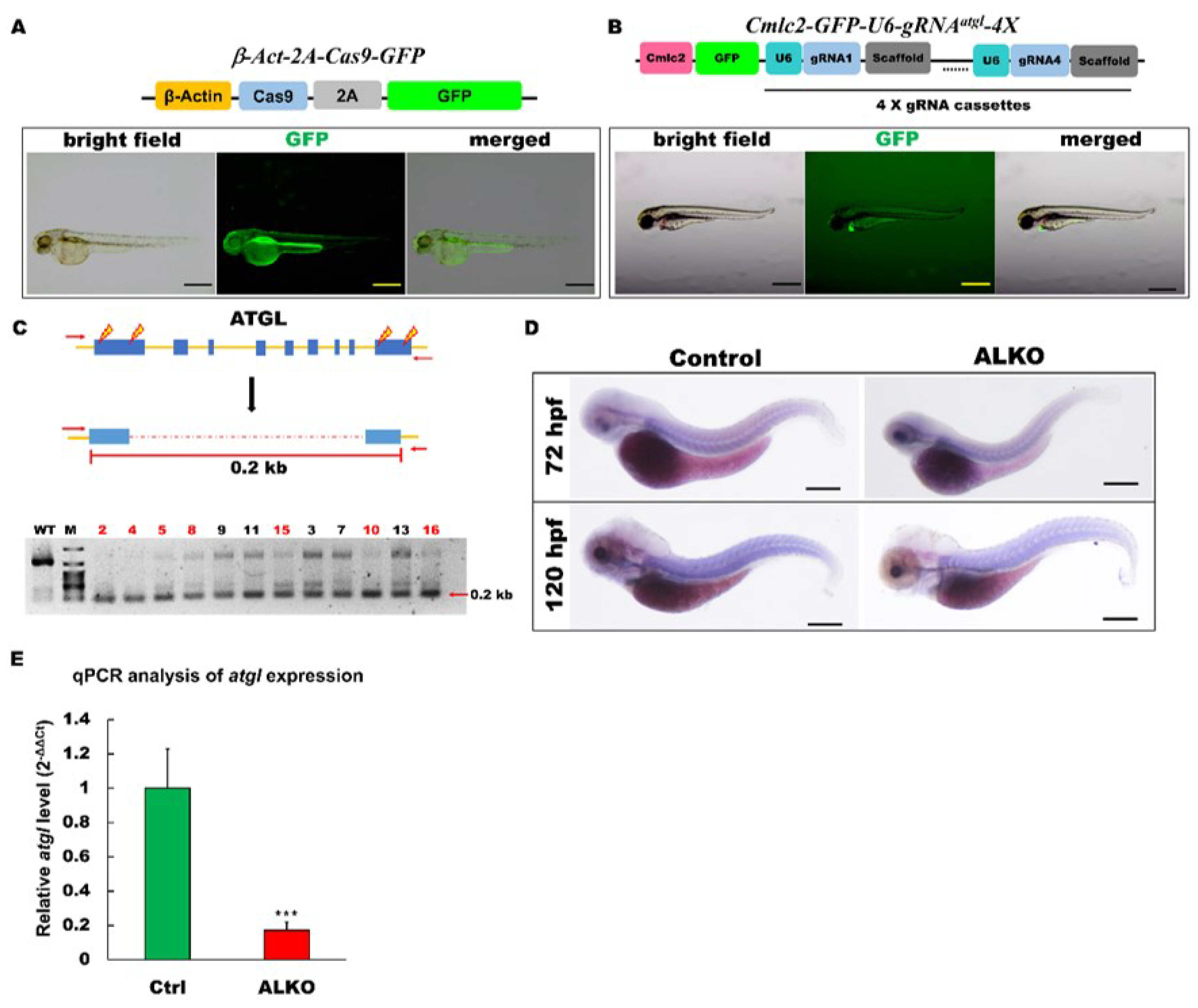 Deficiency of Adipose Triglyceride Lipase Induces Metabolic Syndrome