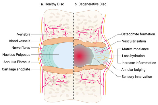 7 Herniated Disc Exercises For Lower Back (Lumbar Area)