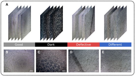 Deep Semantic Segmentation of Angiogenesis Images
