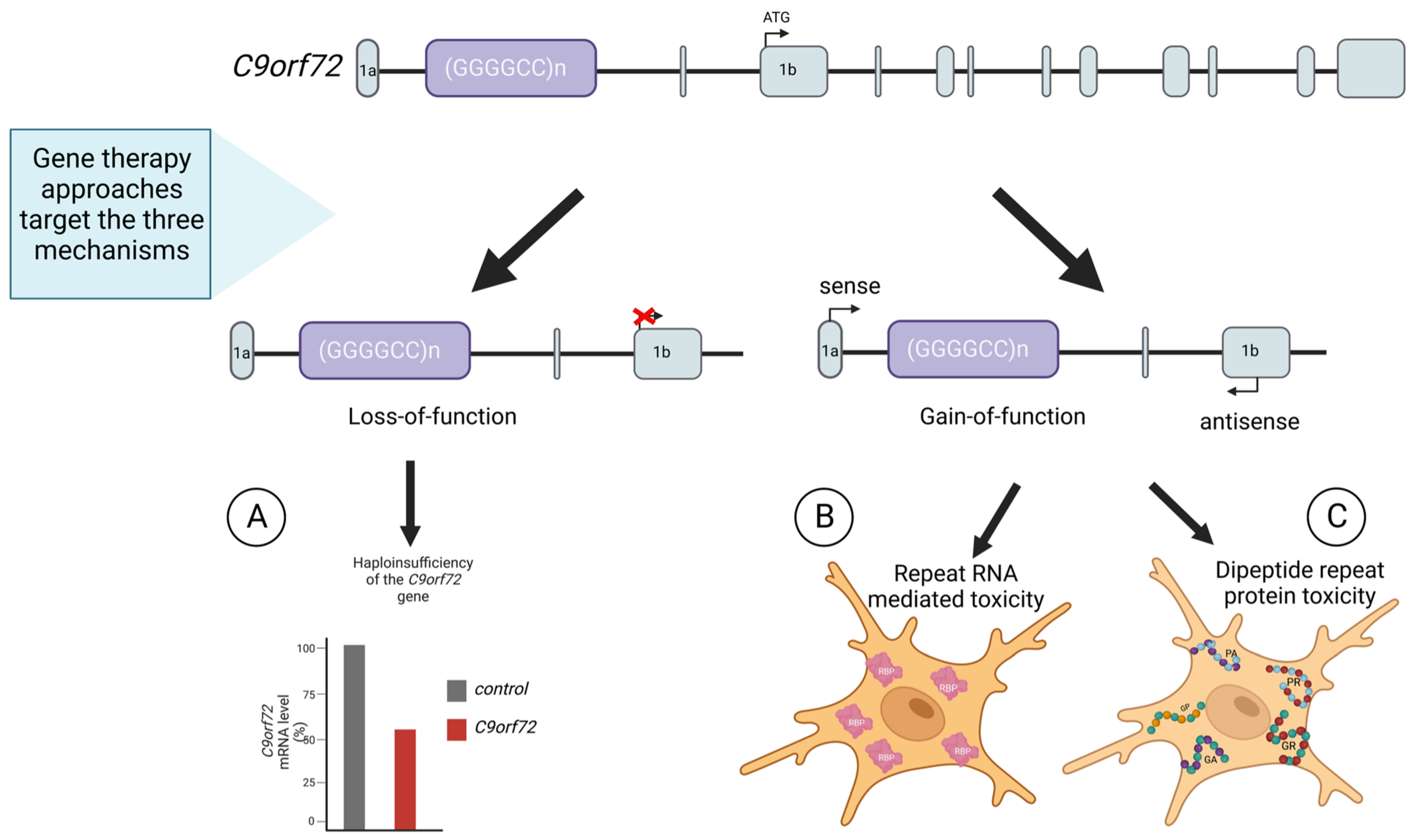 IJMS Free FullText Gene Therapy in ALS and SMA Advances