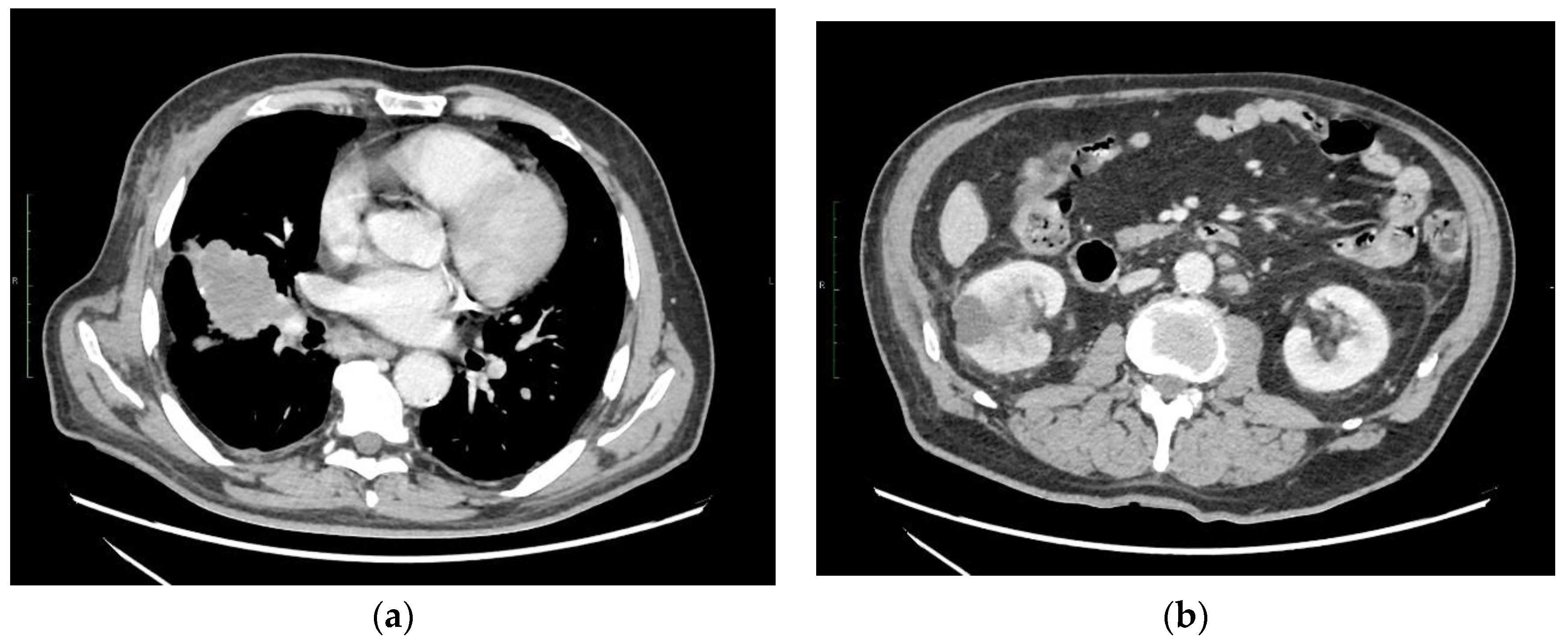 Ijms 24 01195 sch001