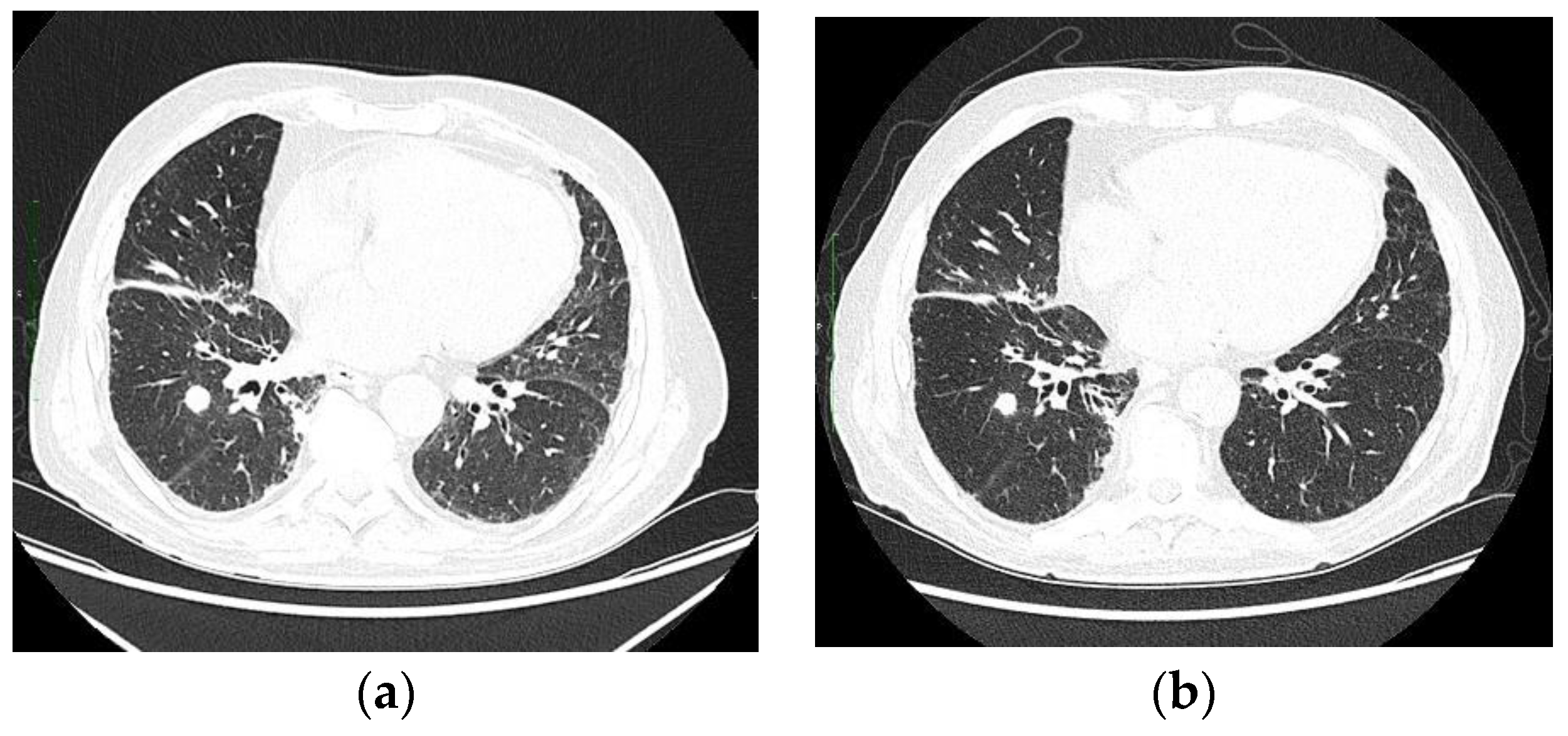 Ijms 24 01195 sch002