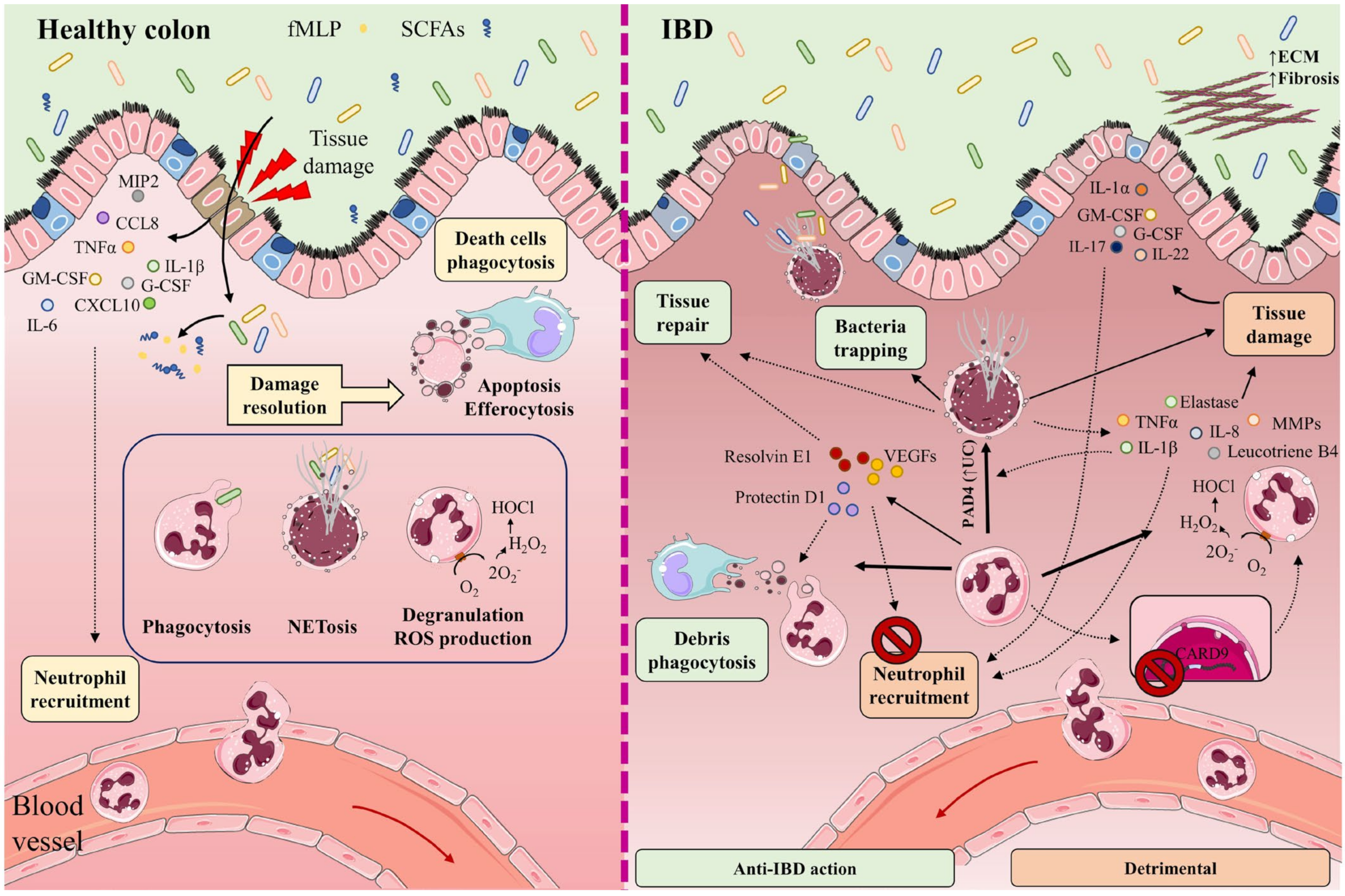 Pathophysiology of Inflammatory Bowel Disease: Innate Immune Pathophysiology of Inflammatory Bowel Disease: Innate Immune