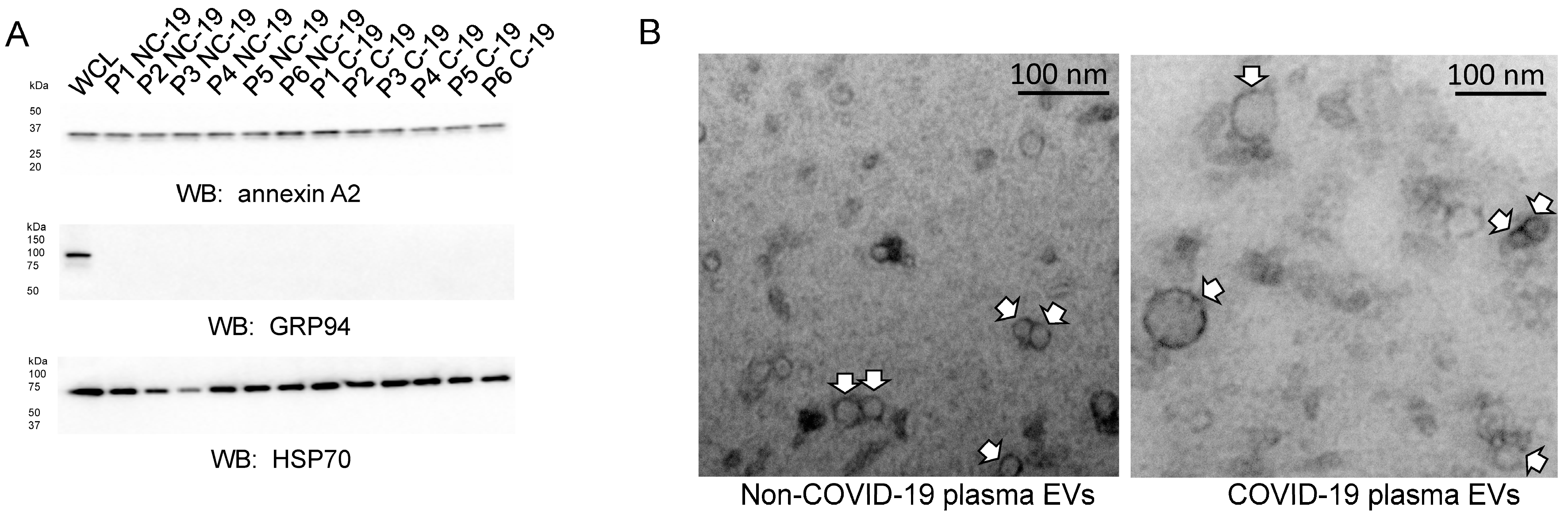 Ijms 24 01654 g003 Ijms 24 01654 g003