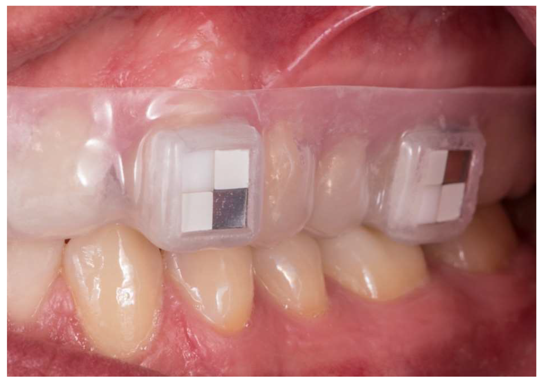 Ijms 24 01779 g005 Ijms 24 01779 g005