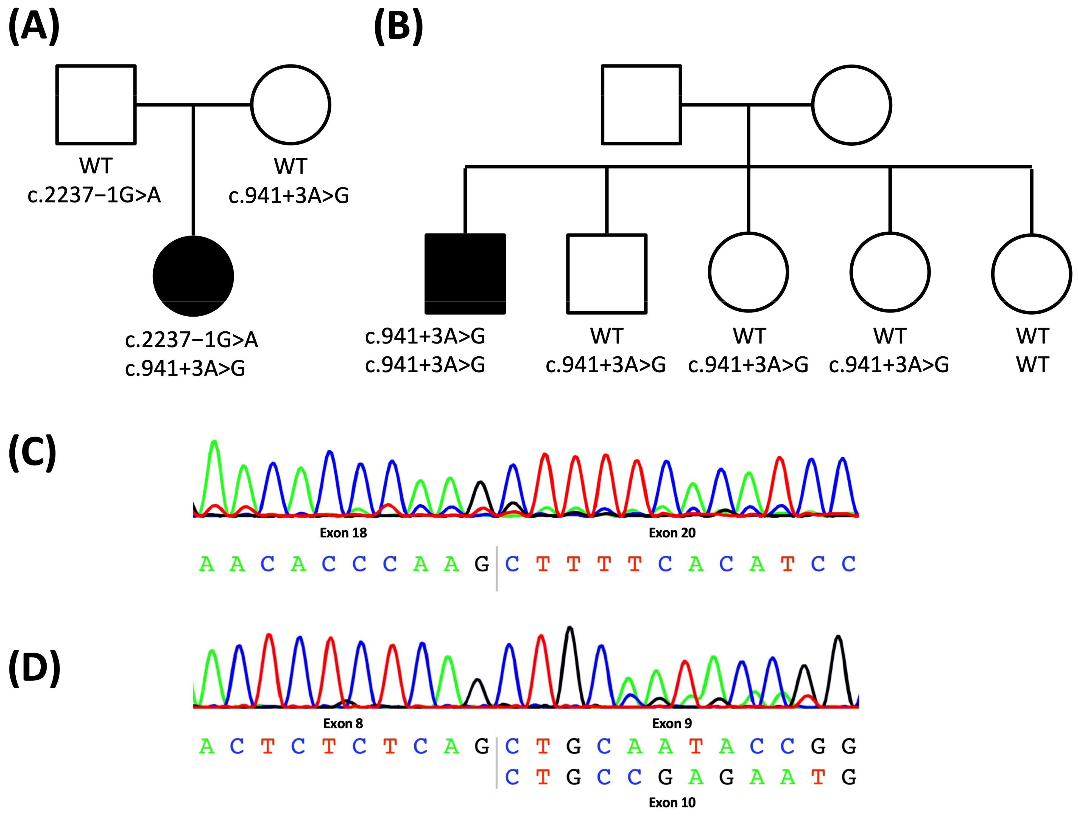 Not to Miss: Intronic Variants, Treatment, and Review of the