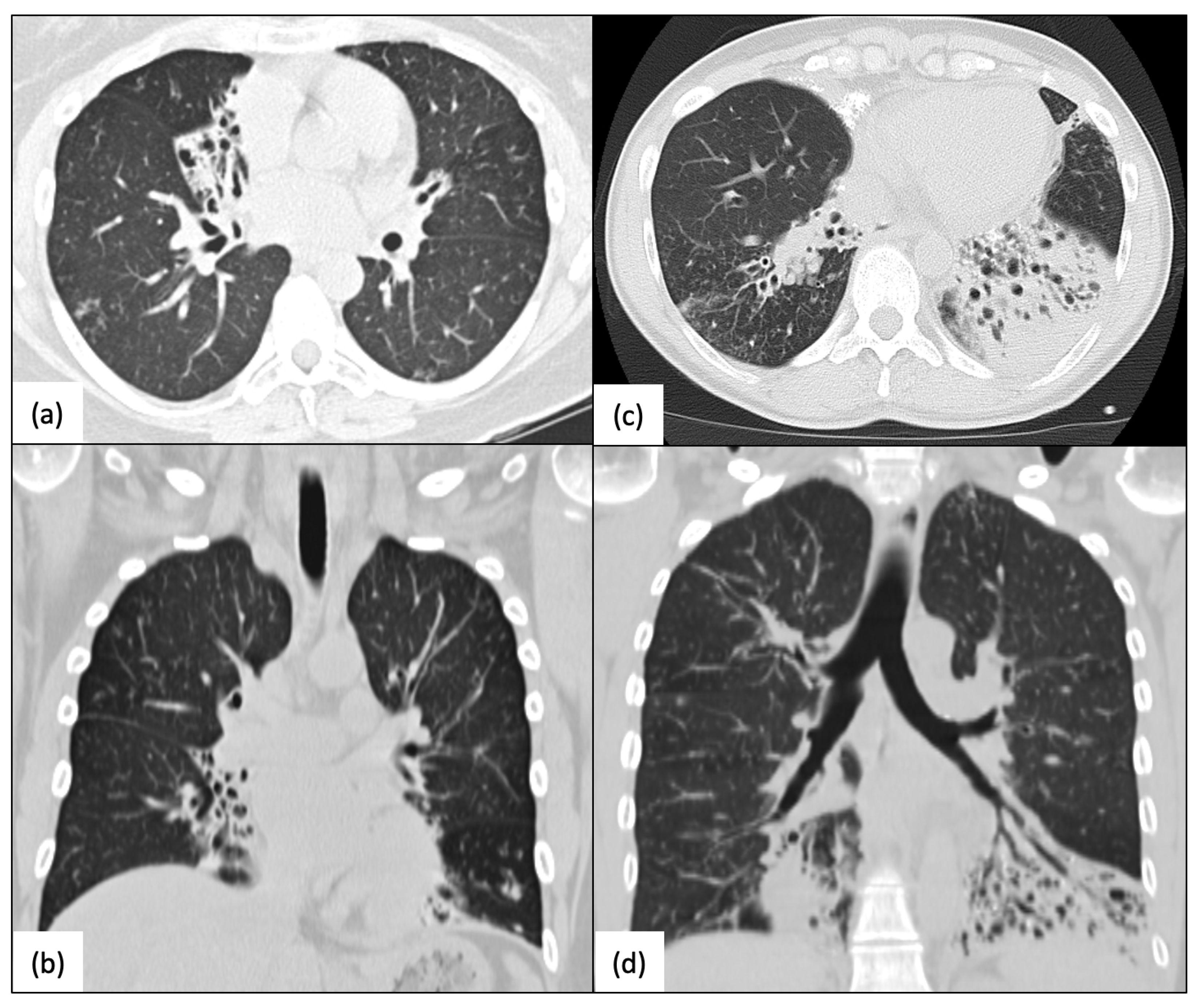 Ijms 24 01936 g004 Ijms 24 01936 g004