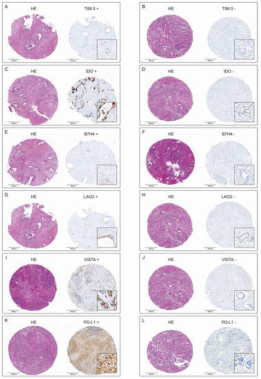 The Immune Checkpoint Landscape in Tumor Cells ... Biology Diagrams