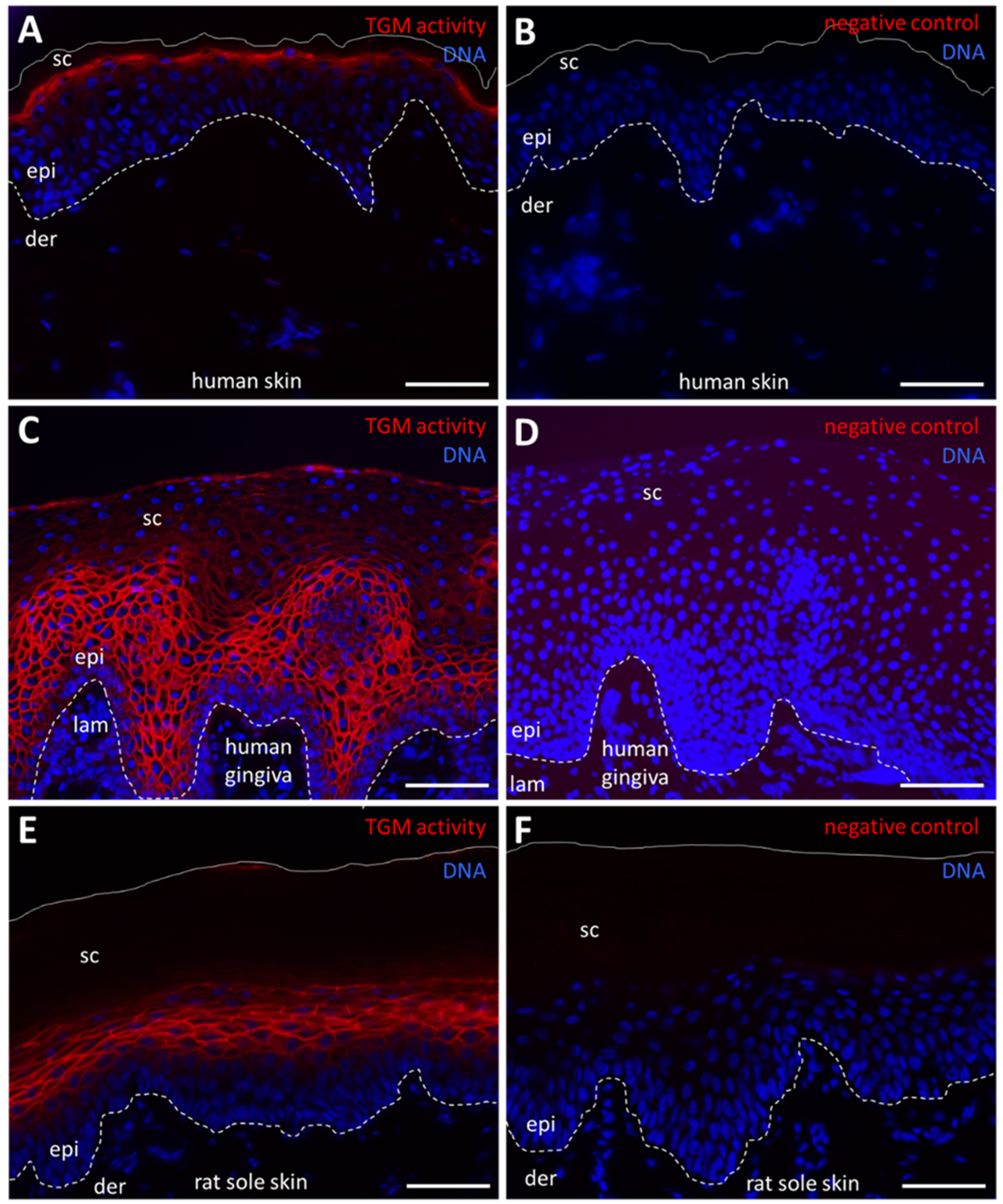 IJMS | Free Full-Text | Transglutaminase Activity Is Conserved in Stratified Epithelia and Skin Appendages of Mammals and Birds IJMS | Free Full-Text | Transglutaminase Activity Is Conserved in Stratified Epithelia and Skin Appendages of Mammals and Birds